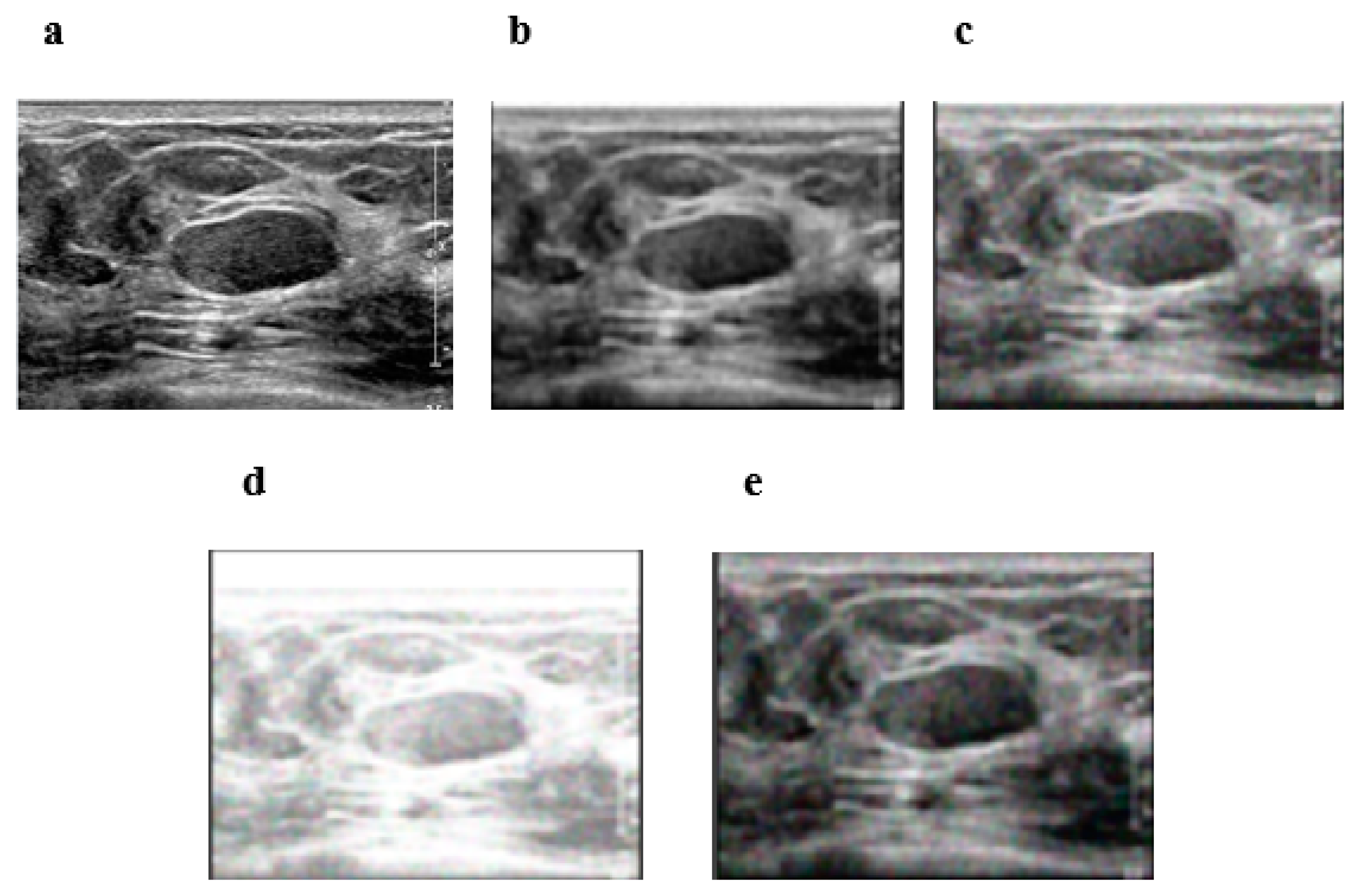 Diagnostics 12 00862 g003