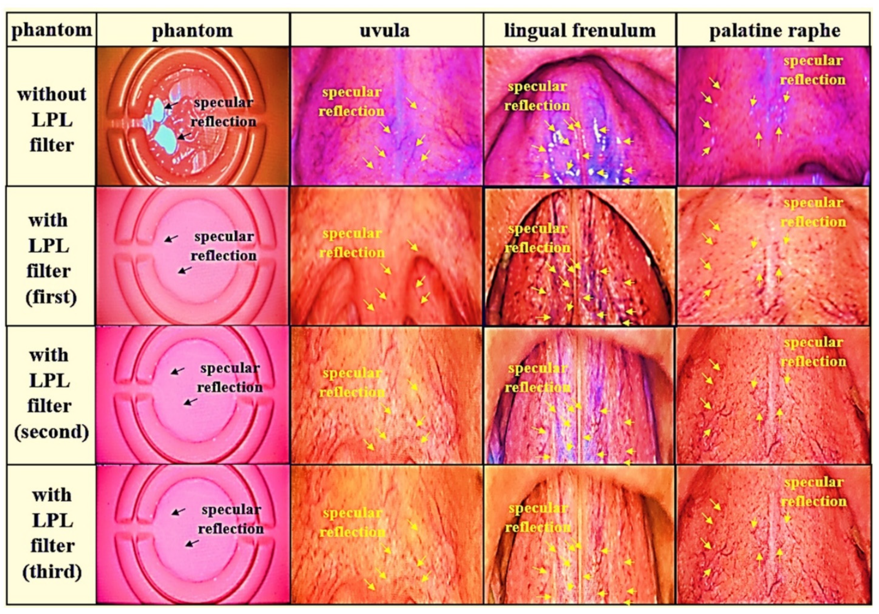 Diagnostics 12 00863 g011 550
