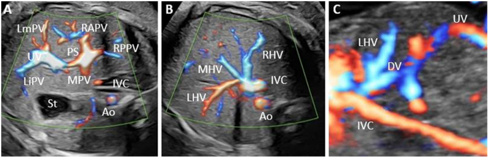 Diagnostics 12 00873 g001 550