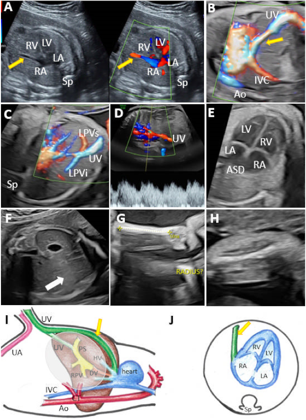 Diagnostics 12 00873 g003 550