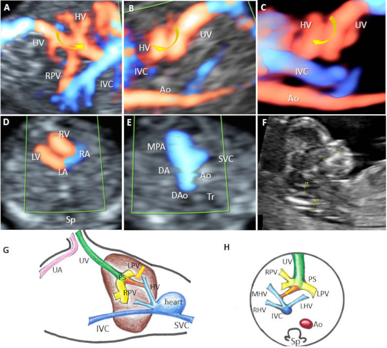 Diagnostics 12 00873 g004 550