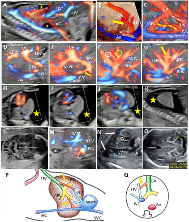 Diagnostics 12 00873 g006 550