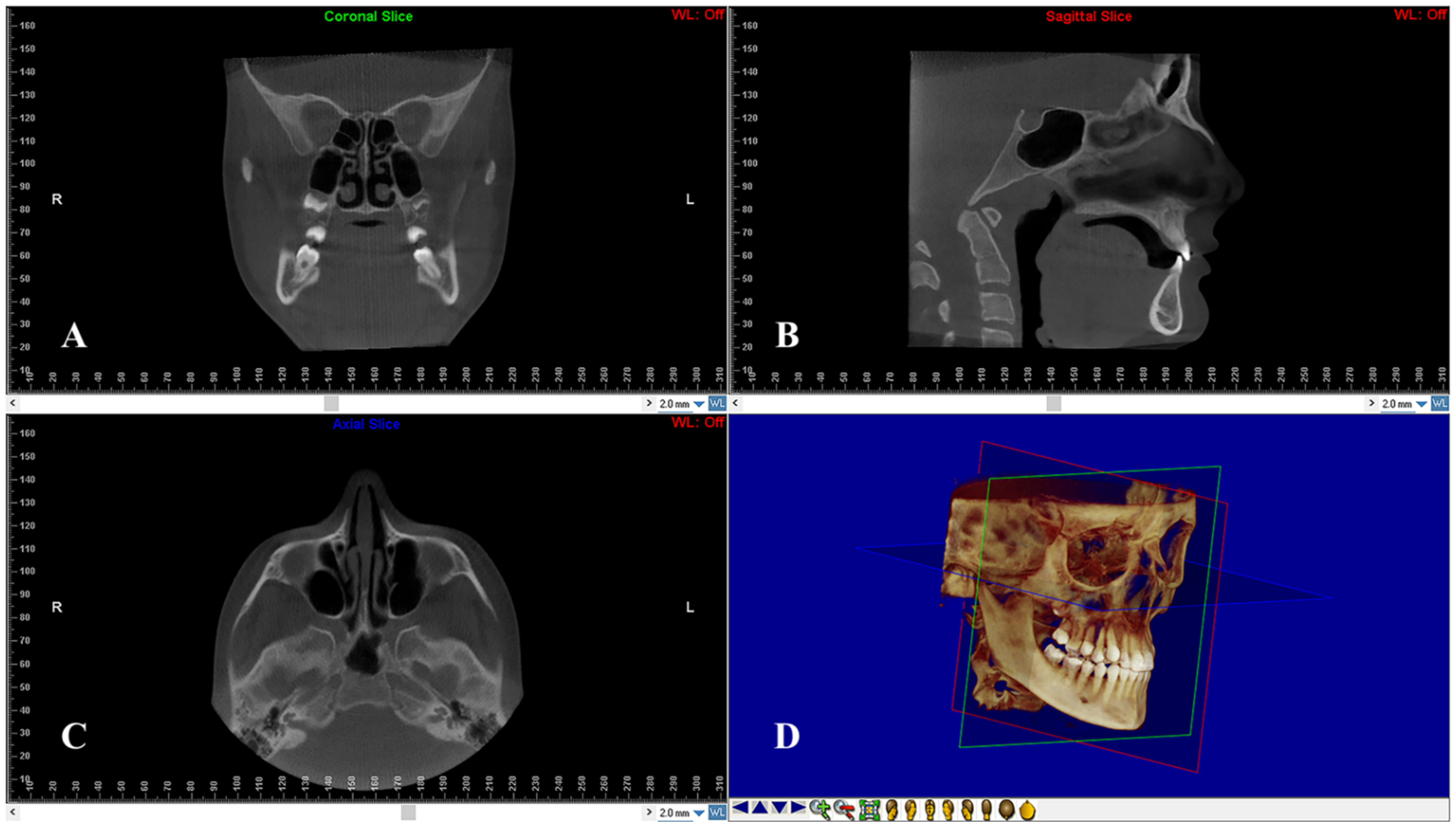 Diagnostics 12 00875 g002 550