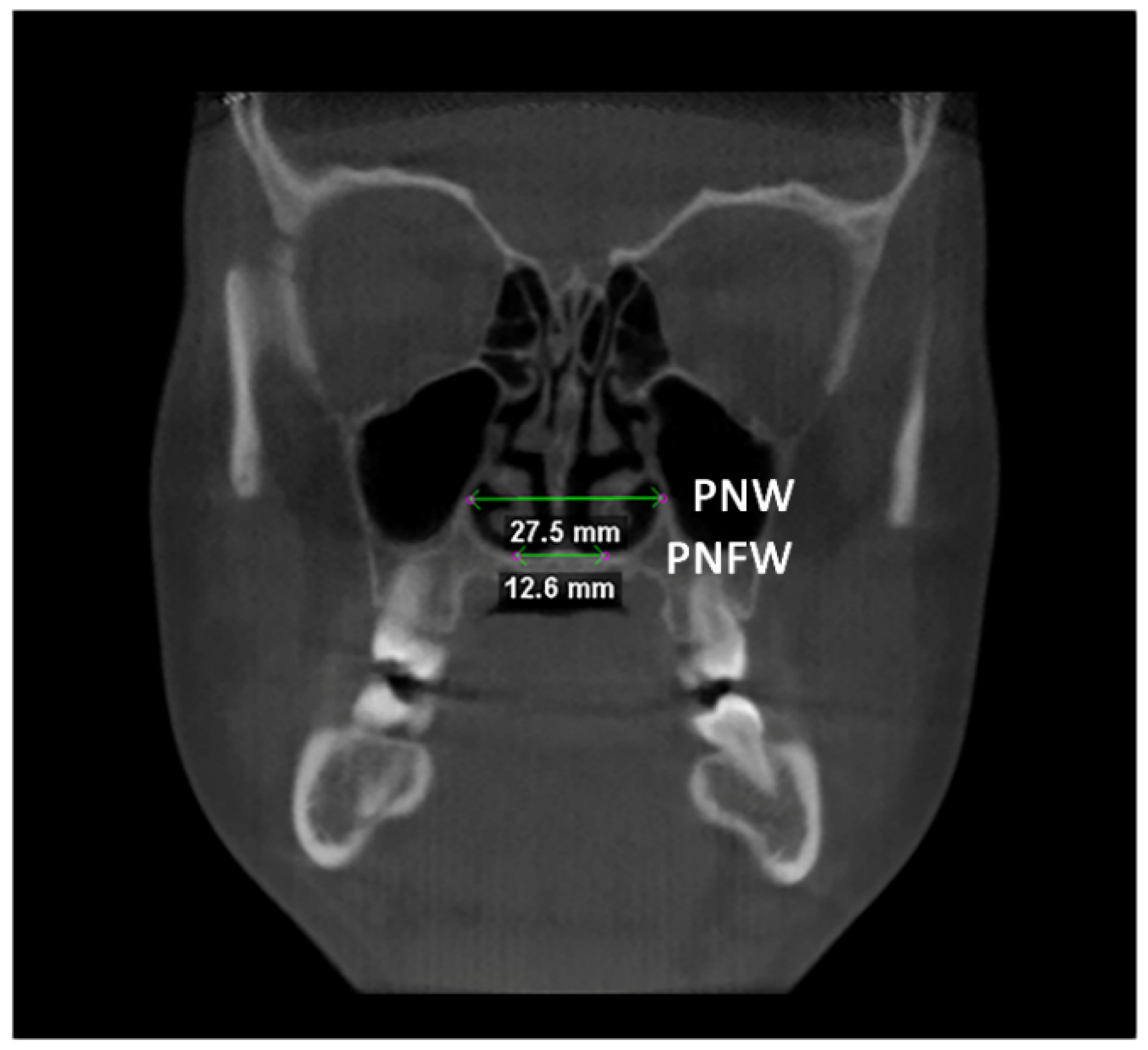 Diagnostics 12 00875 g004 550