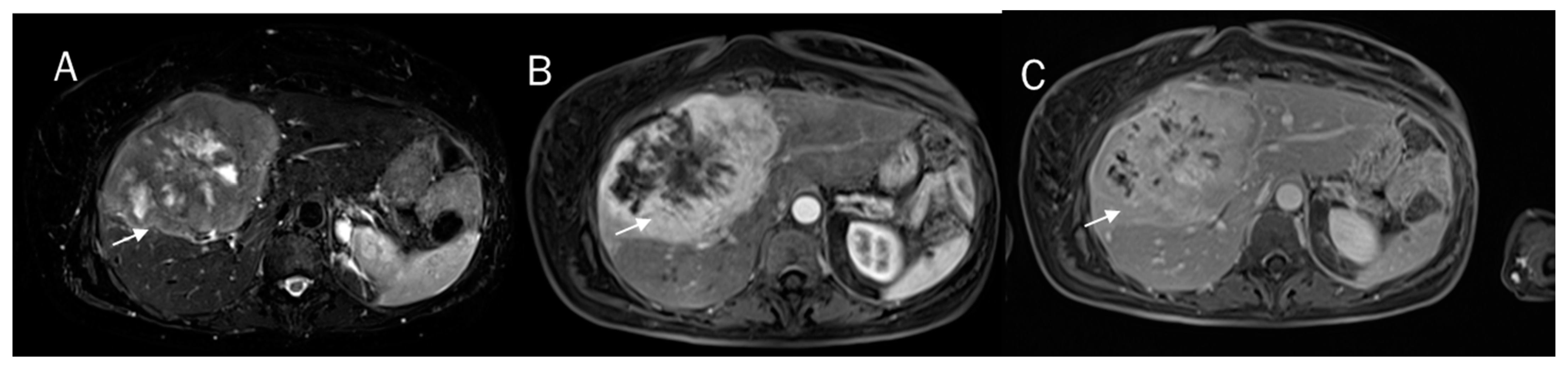 Diagnostics 12 00890 g001