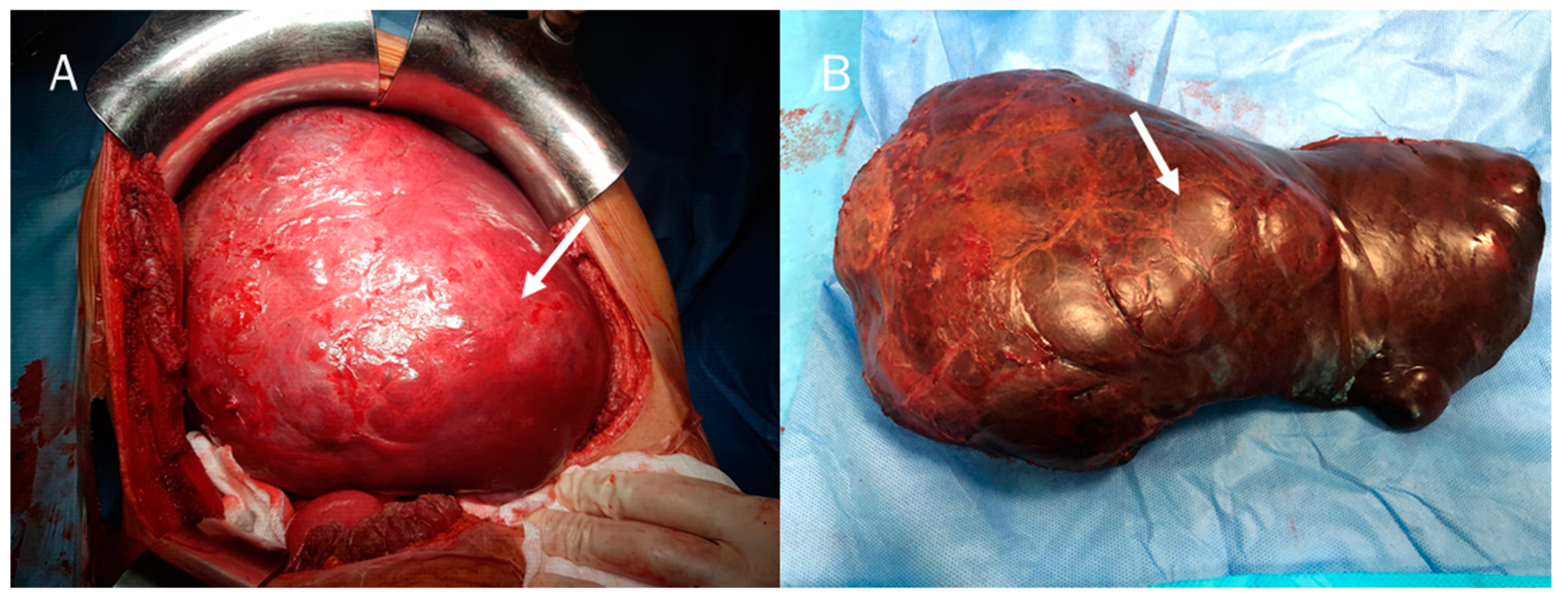 Diagnostics 12 00890 g004