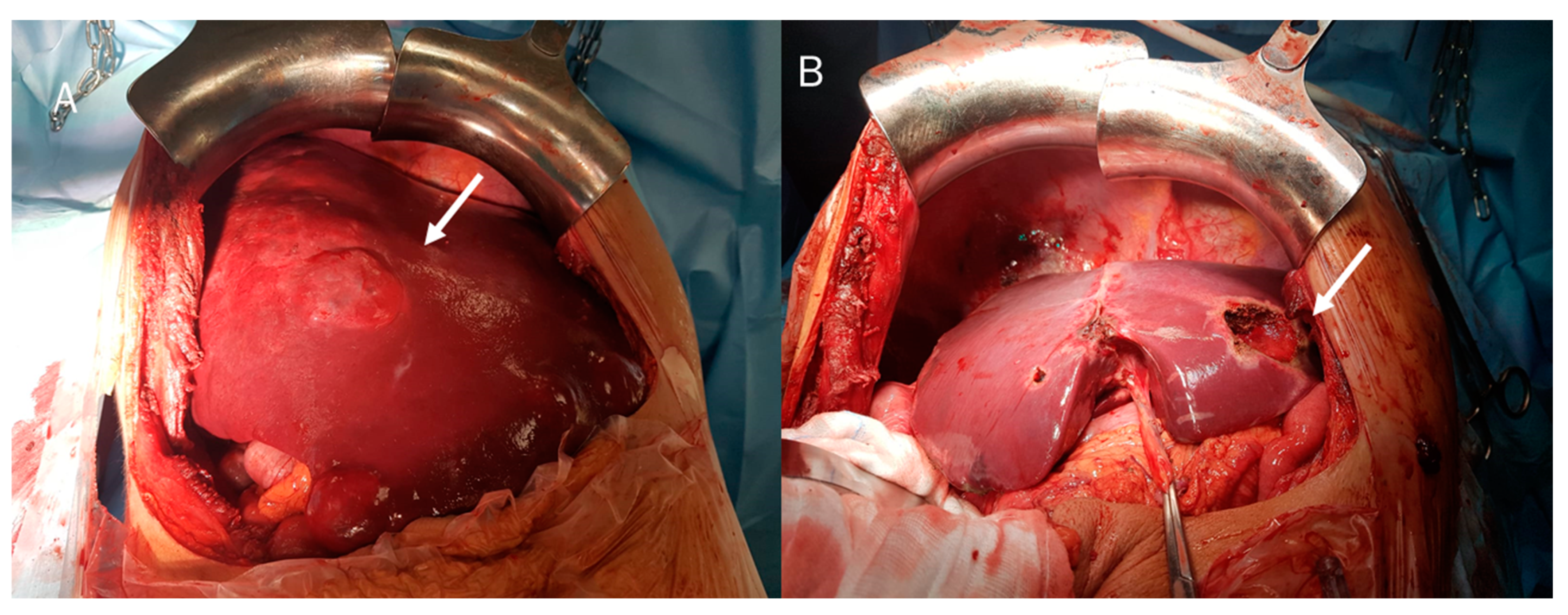 Diagnostics 12 00890 g005