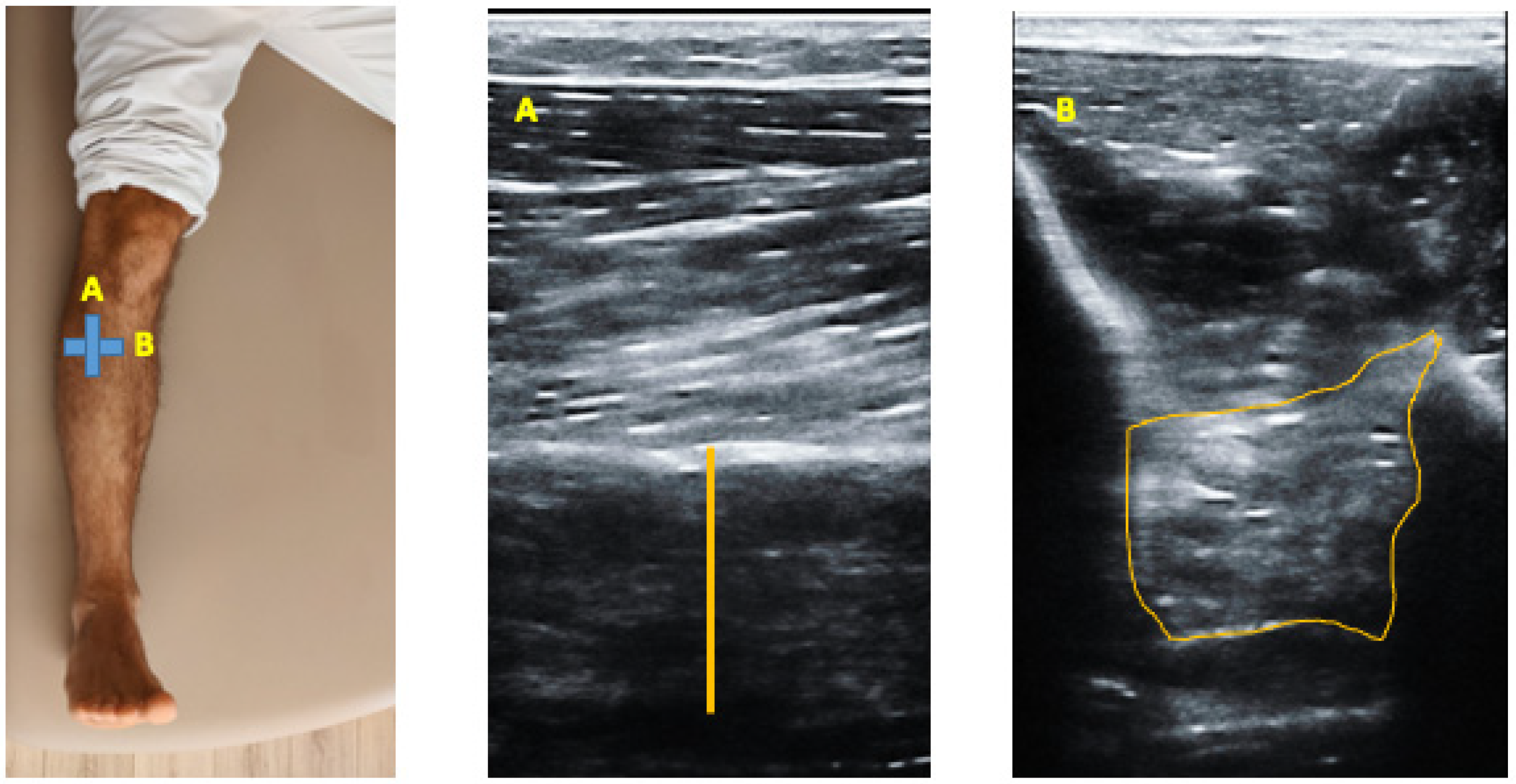 Diagnostics 12 00897 g001