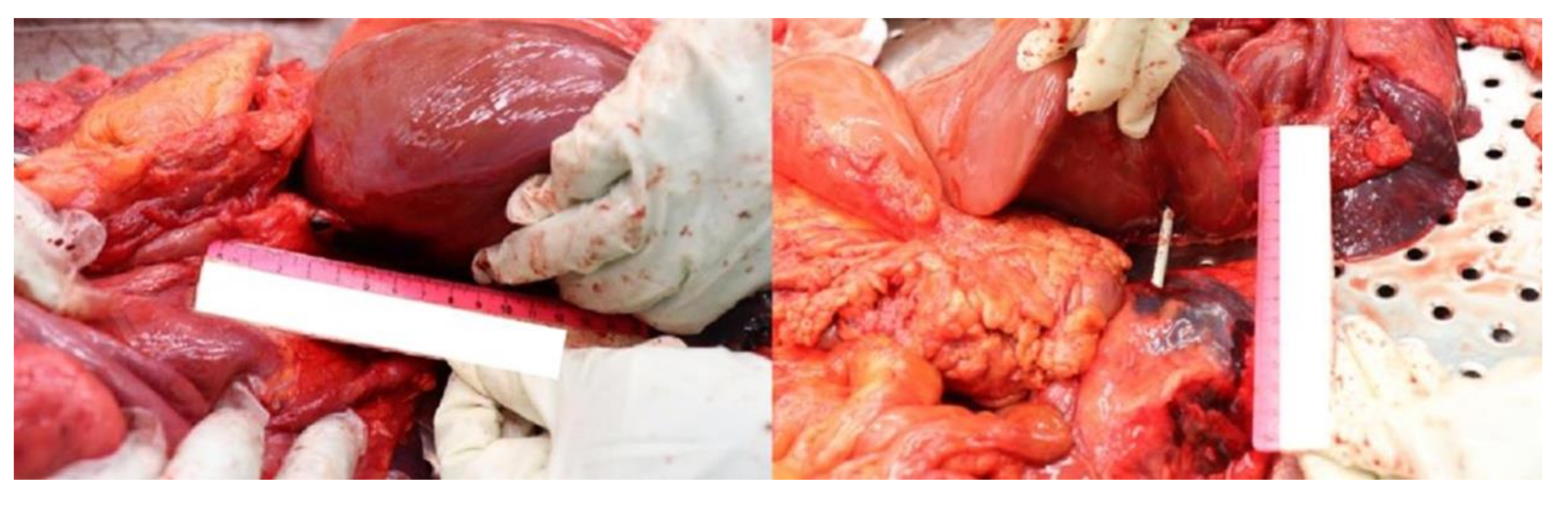 Diagnostics 12 00899 g005 550