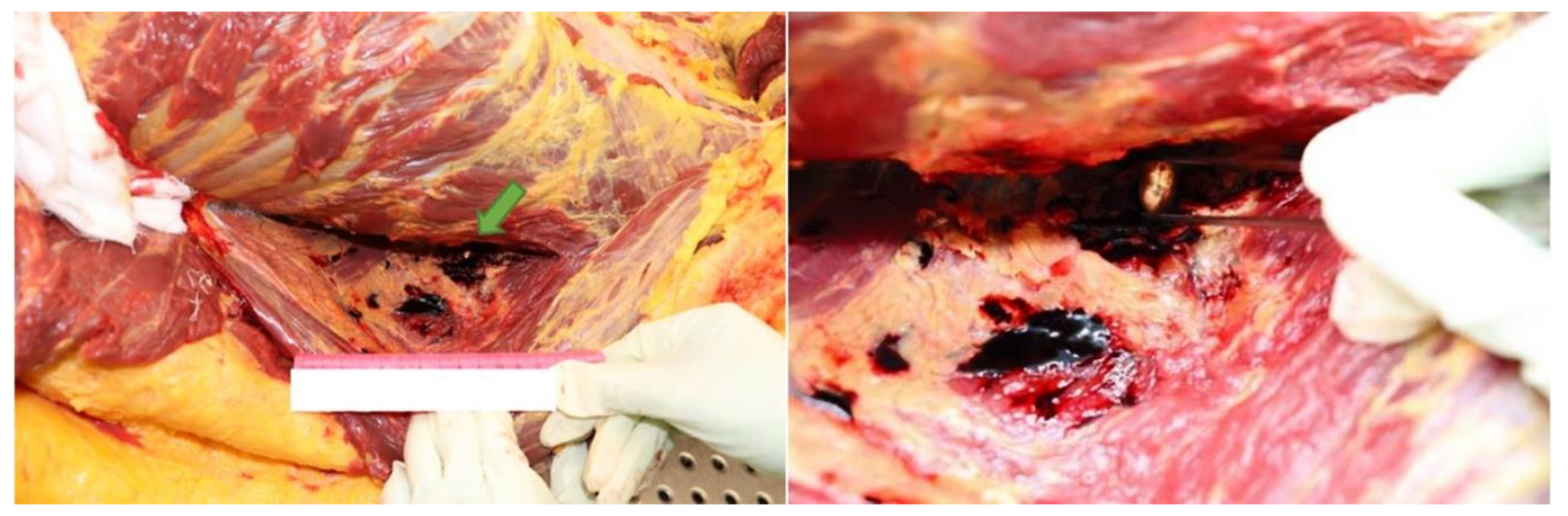 Diagnostics 12 00899 g006 550