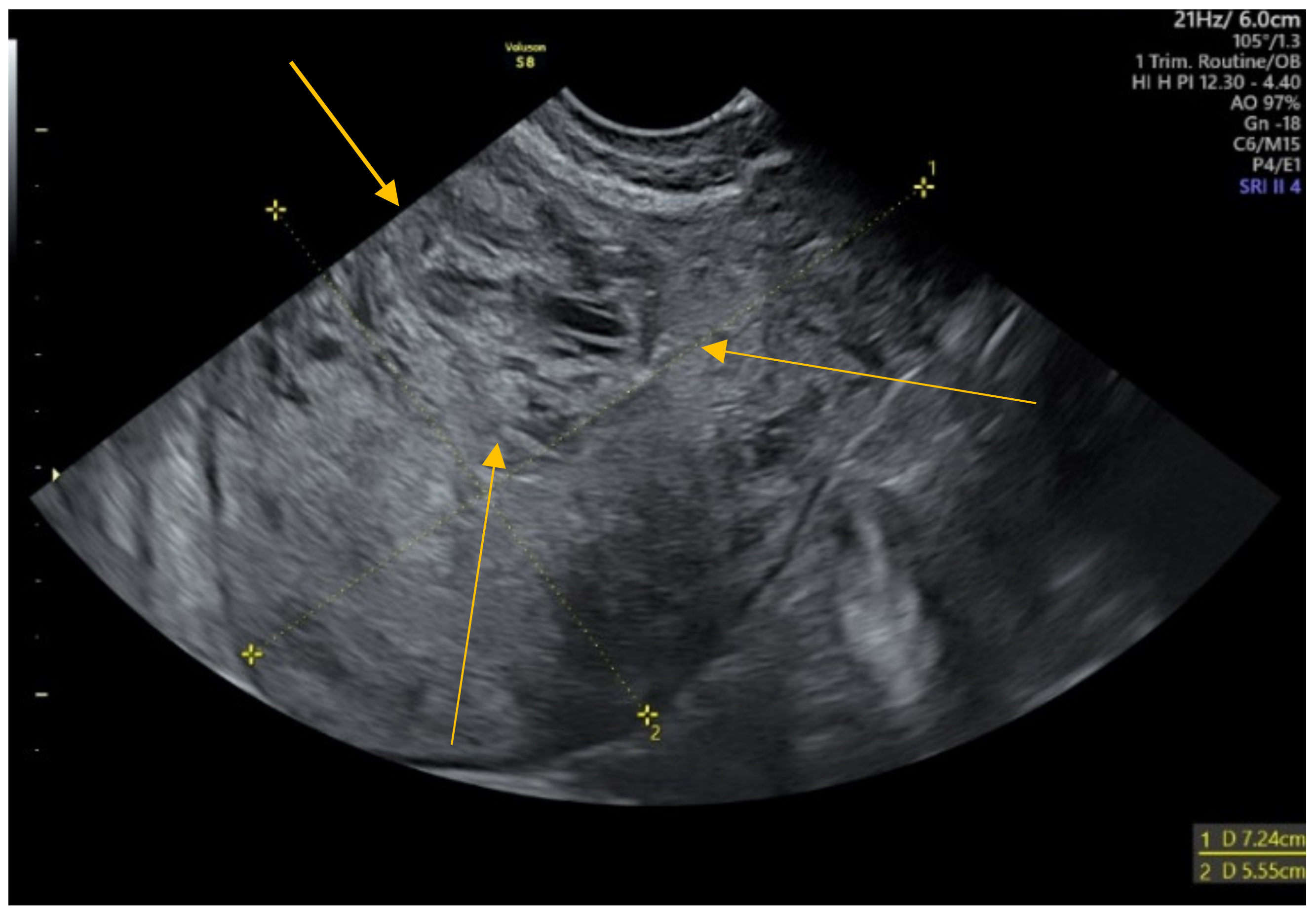 Diagnostics 12 00904 g001 Diagnostics 12 00904 g001