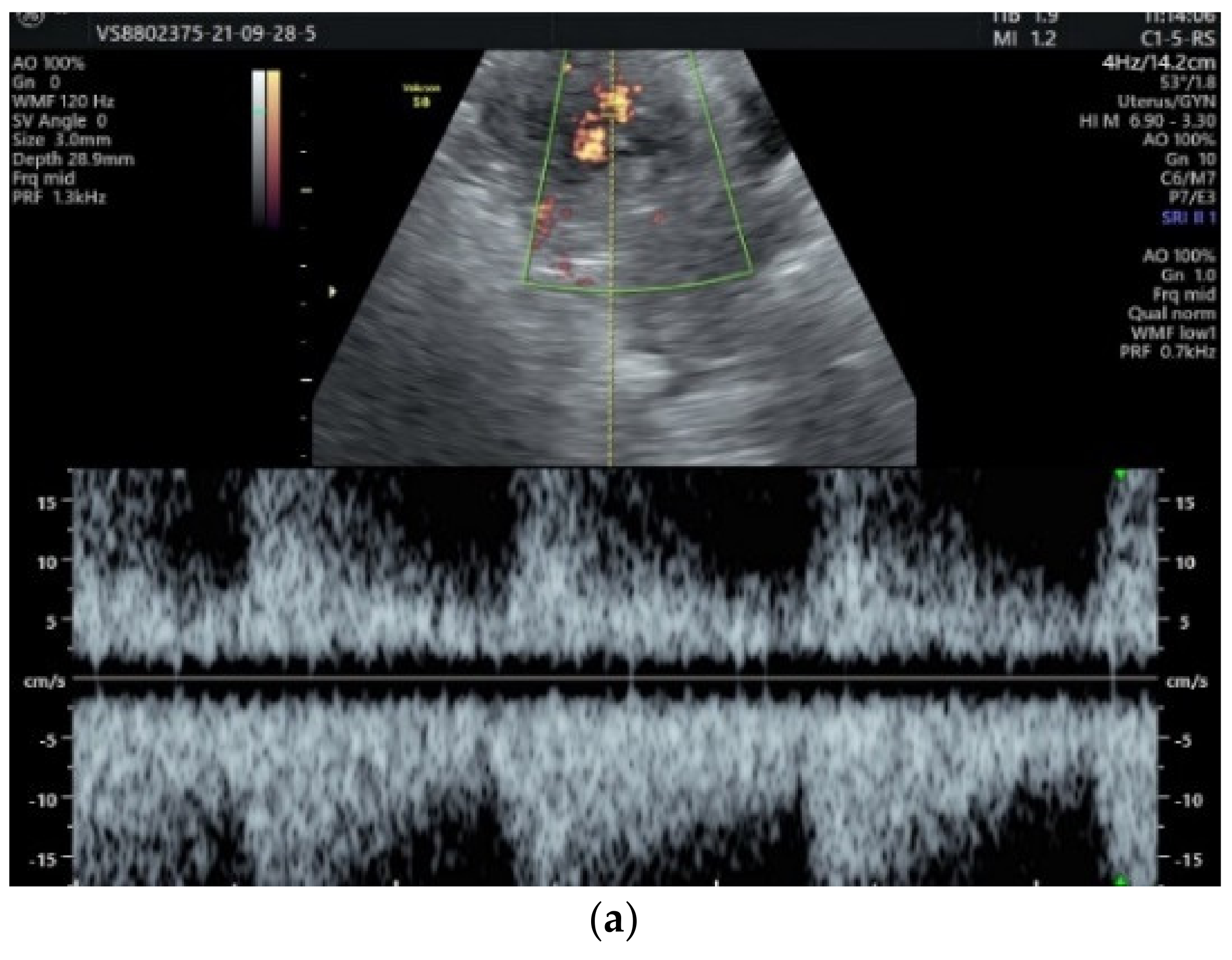 Diagnostics 12 00904 g003a Diagnostics 12 00904 g003a