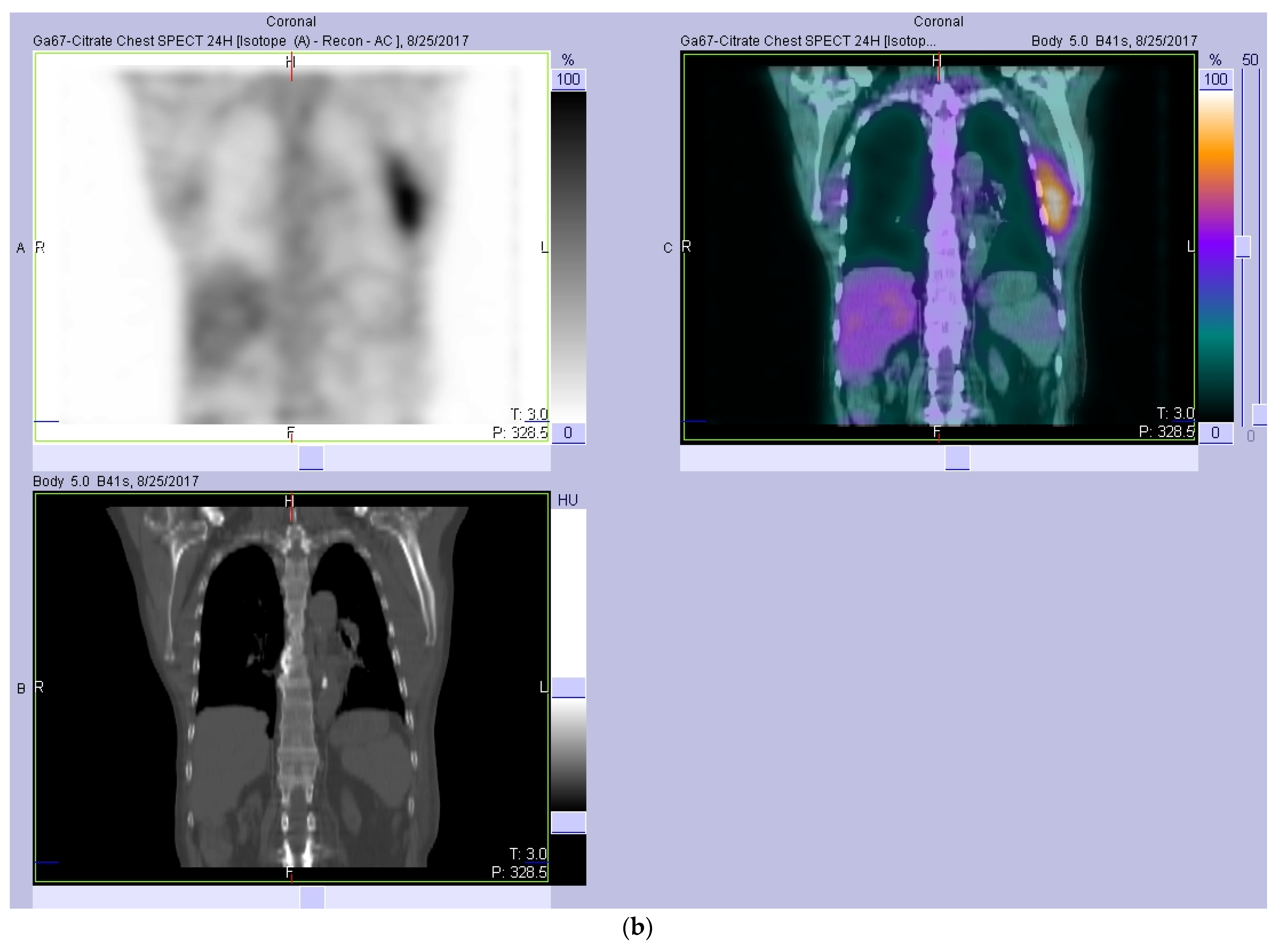 Diagnostics 12 00906 g001c