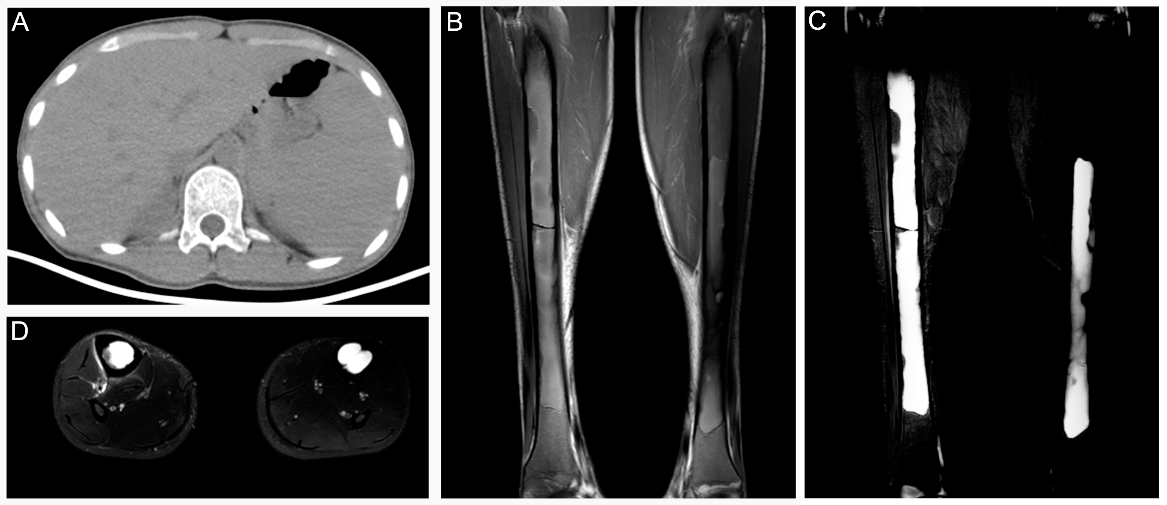 Diagnostics 12 00910 g001
