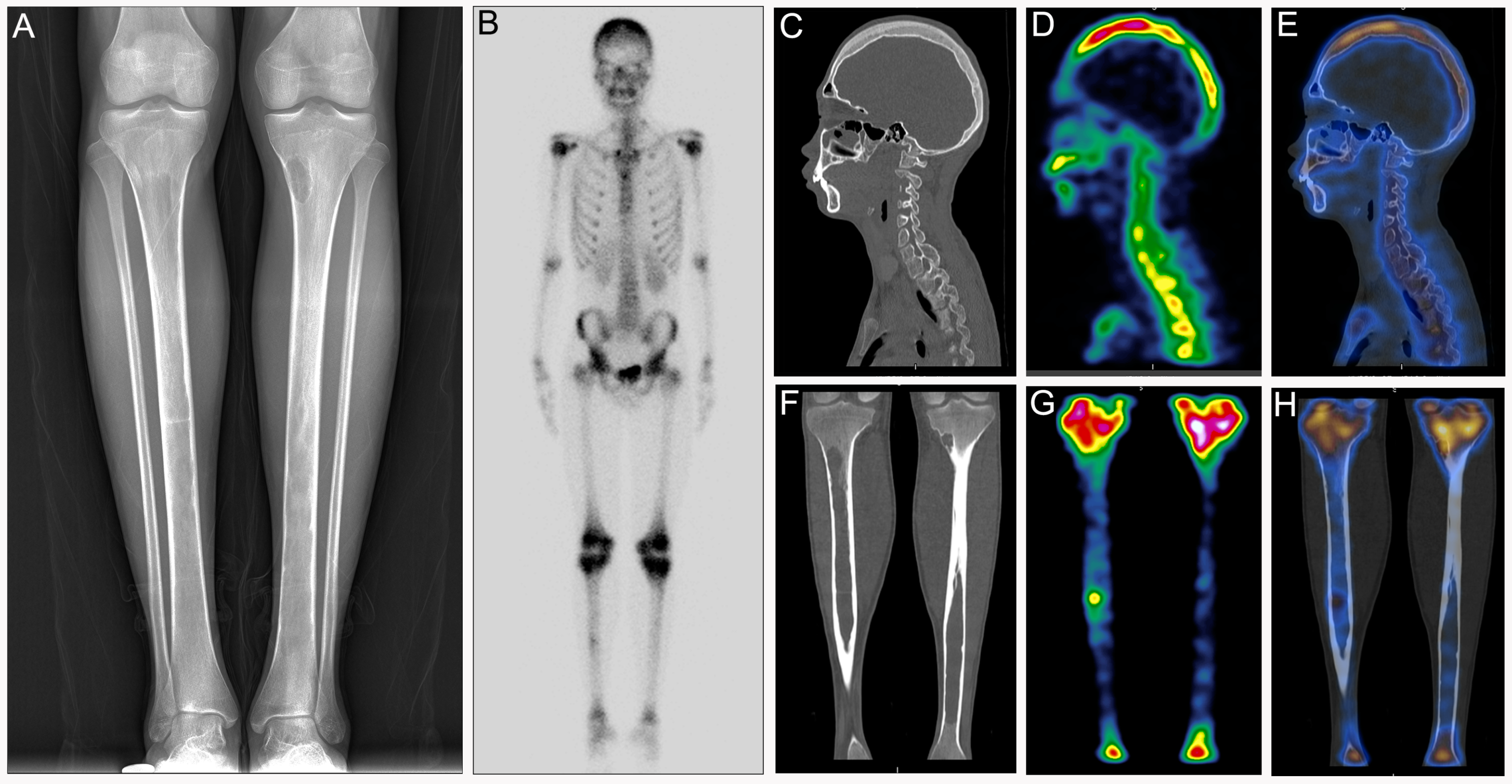 Diagnostics 12 00910 g002