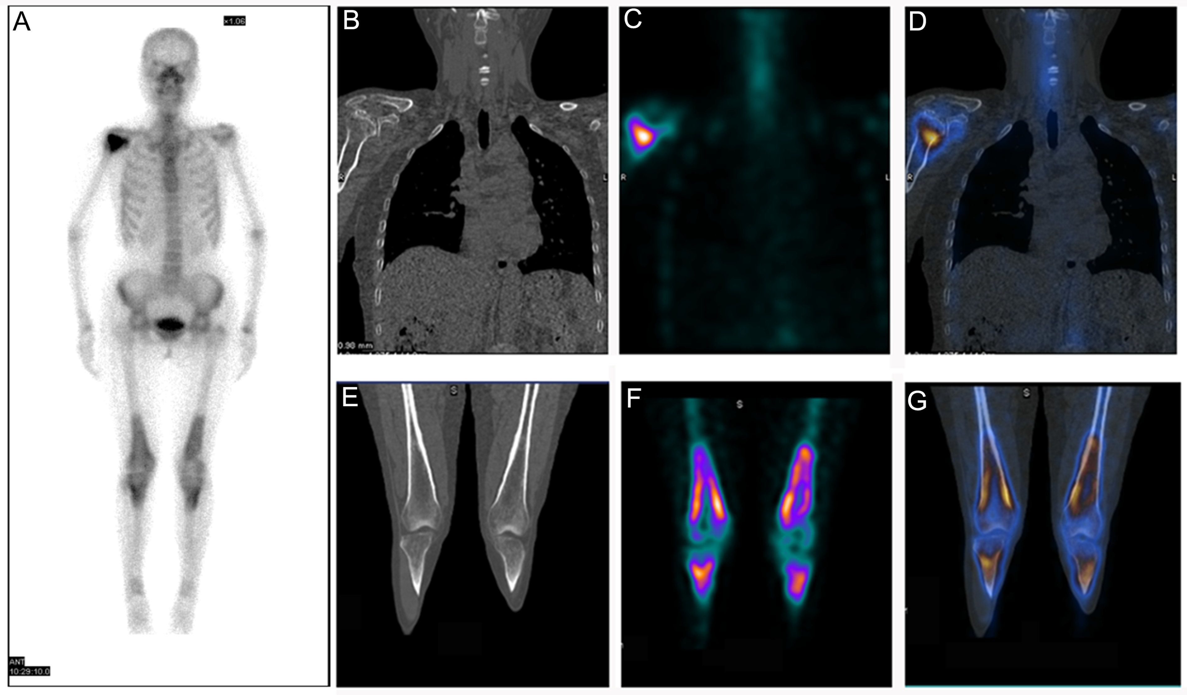 Diagnostics 12 00910 g003