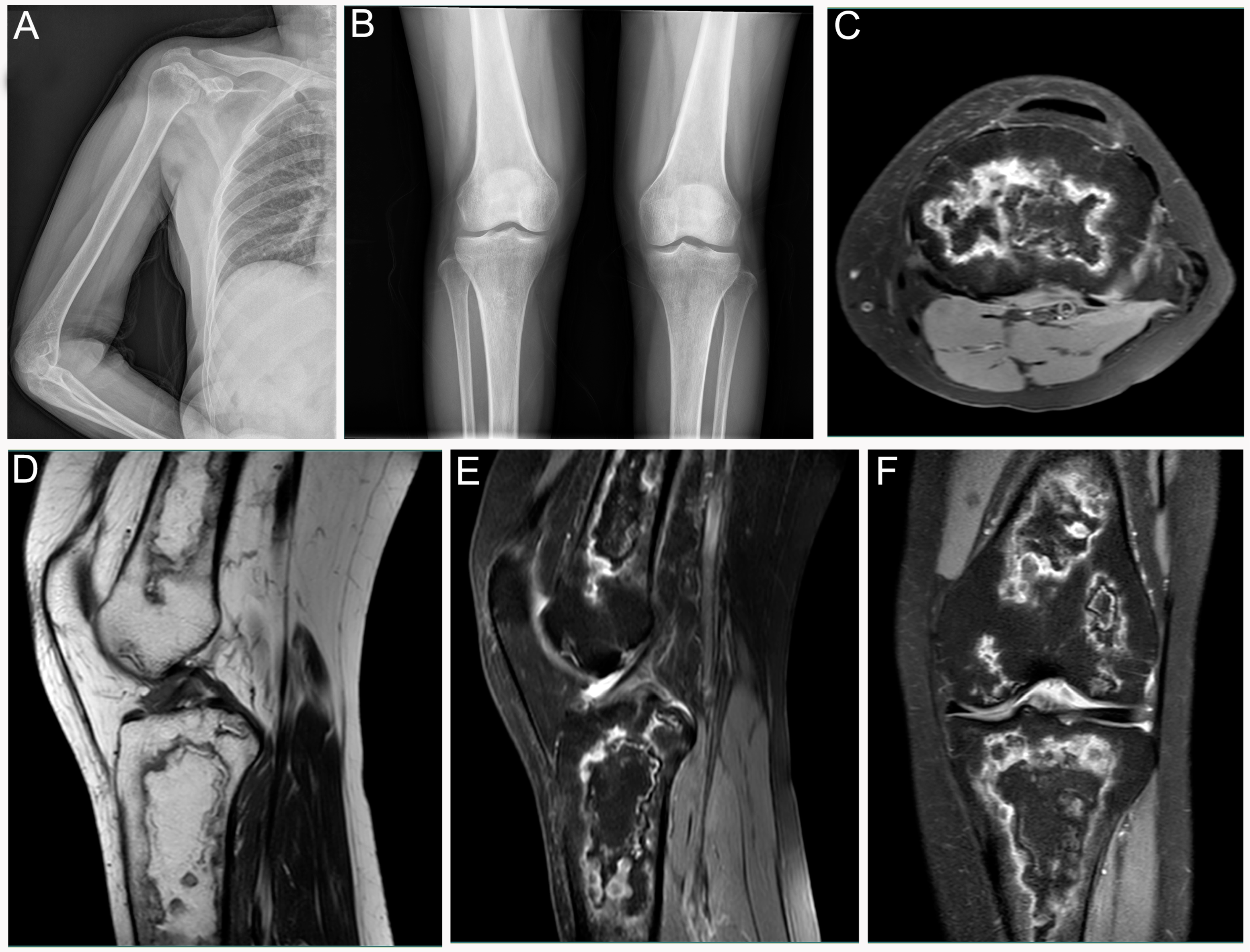 Differential Diagnosis of Rare Diseases Involving Bilateral Differential Diagnosis of Rare Diseases Involving Bilateral