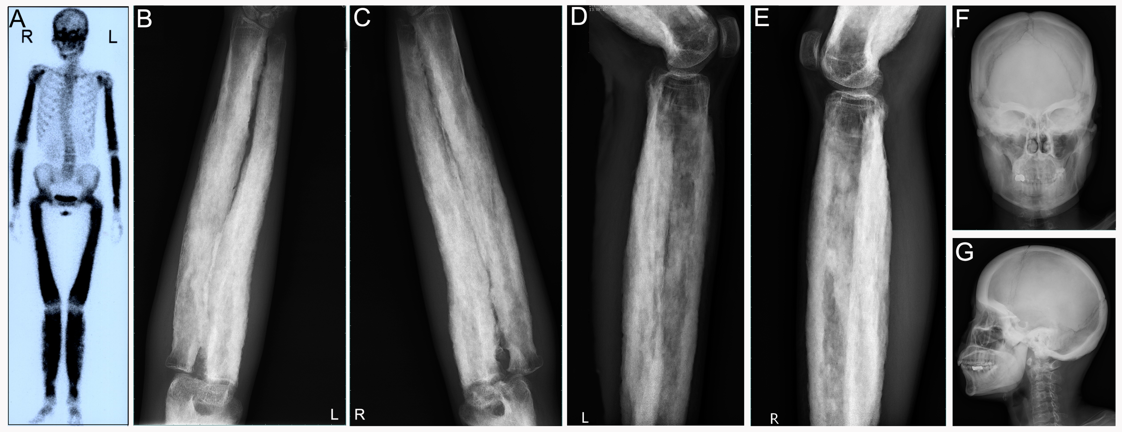 Diagnostics 12 00910 g005