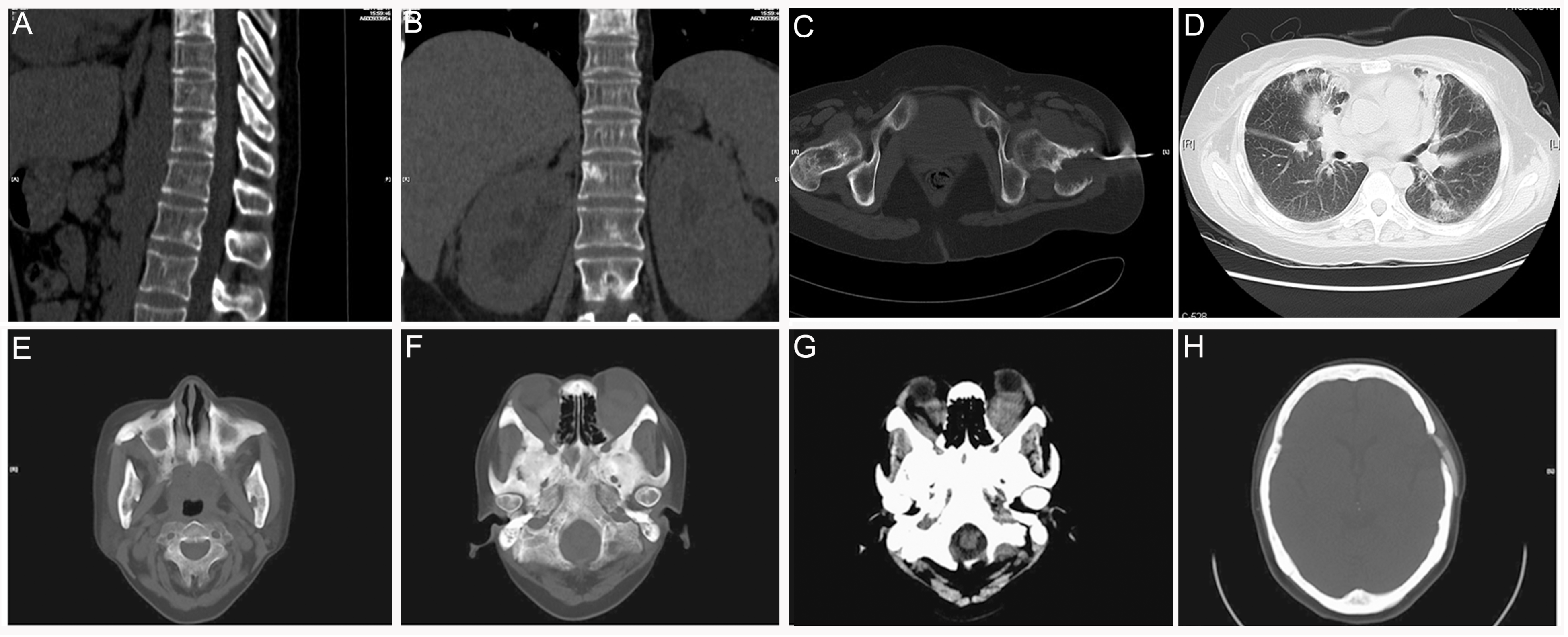 Diagnostics 12 00910 g008