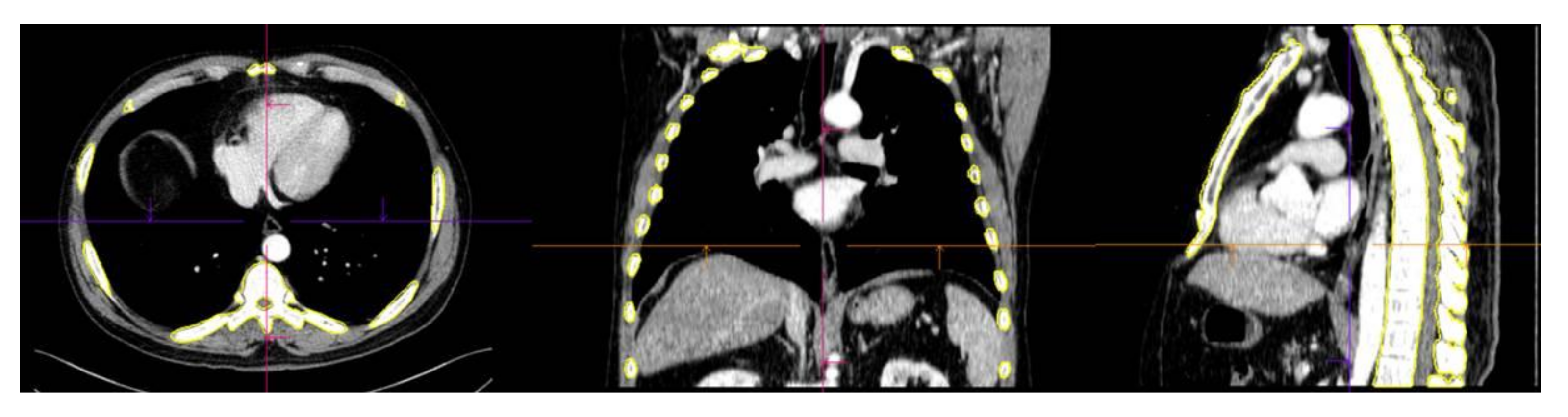 Diagnostics 12 00923 g002
