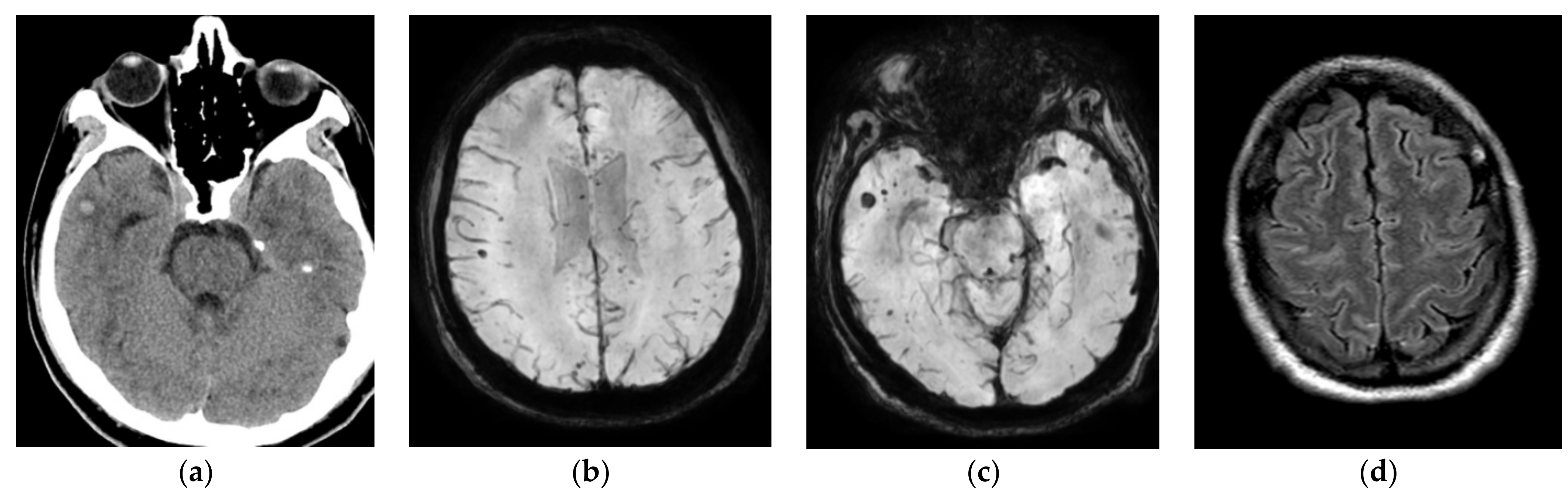 Diagnostics 12 00924 g002 550