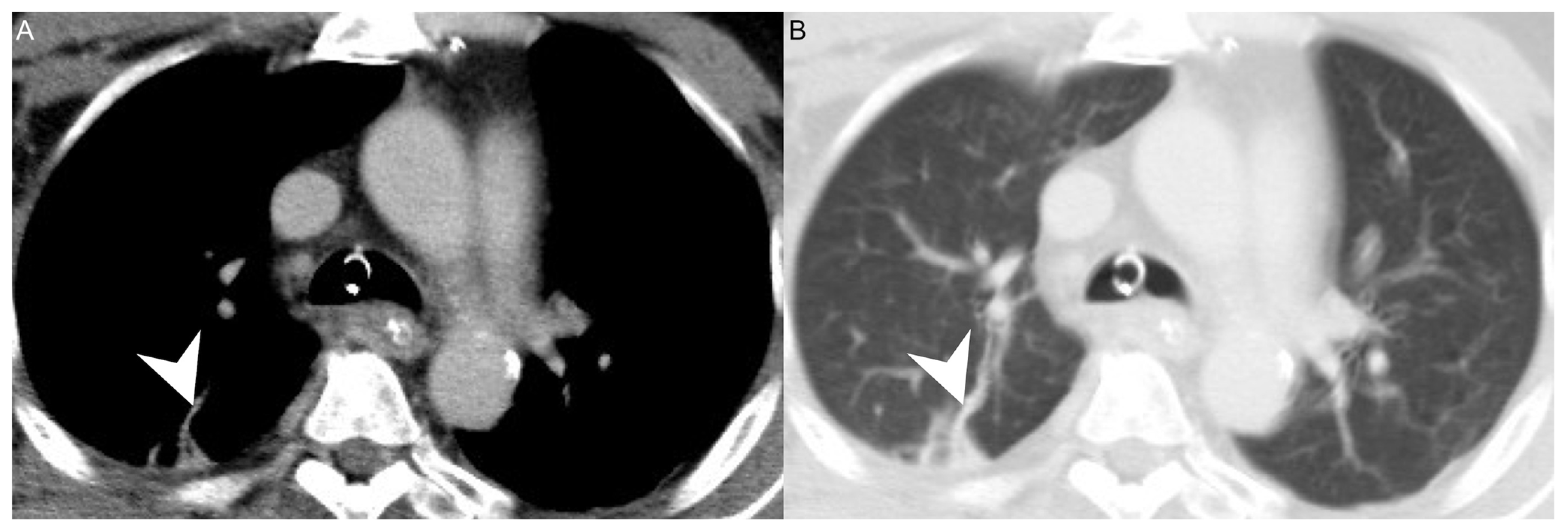 Diagnostics 12 00928 g002
