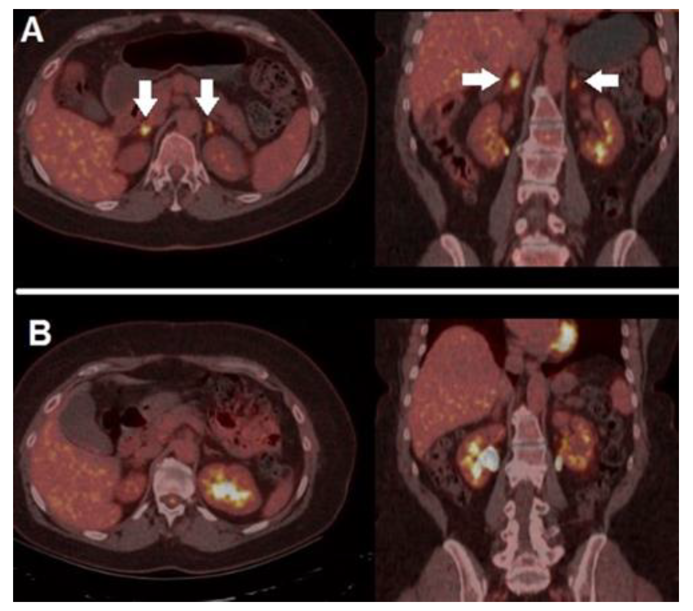 Diagnostics 12 00929 g004 Diagnostics 12 00929 g004