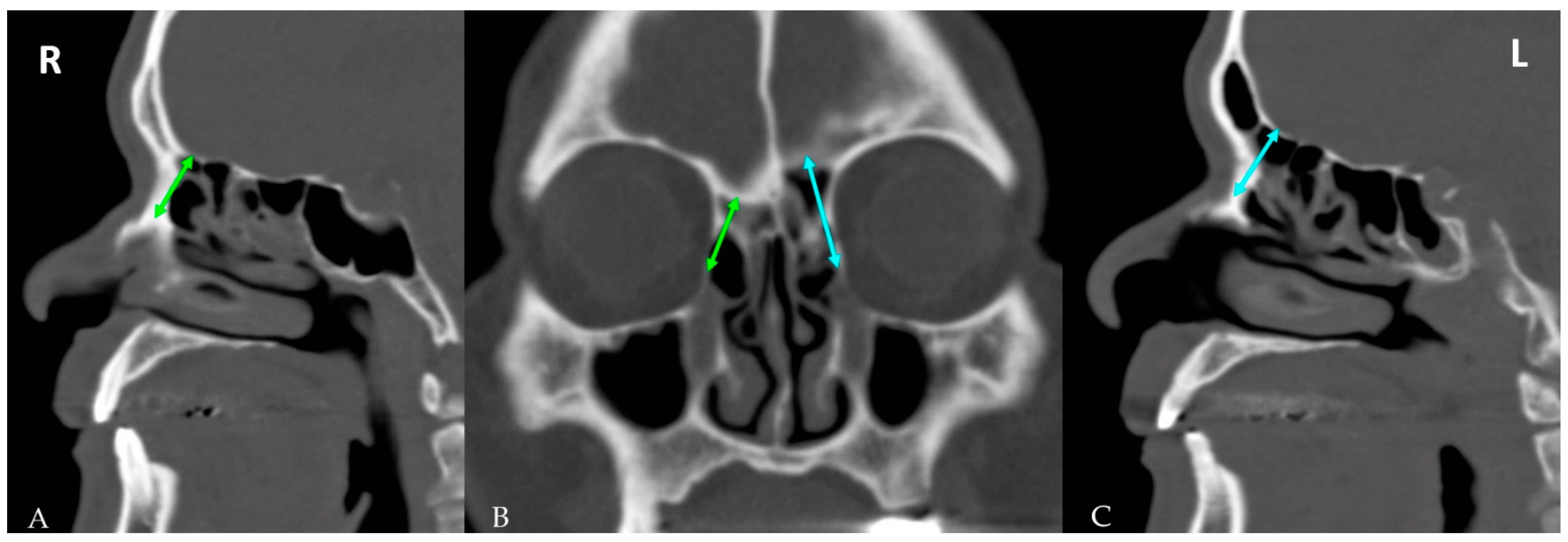 Diagnostics 12 00930 g003