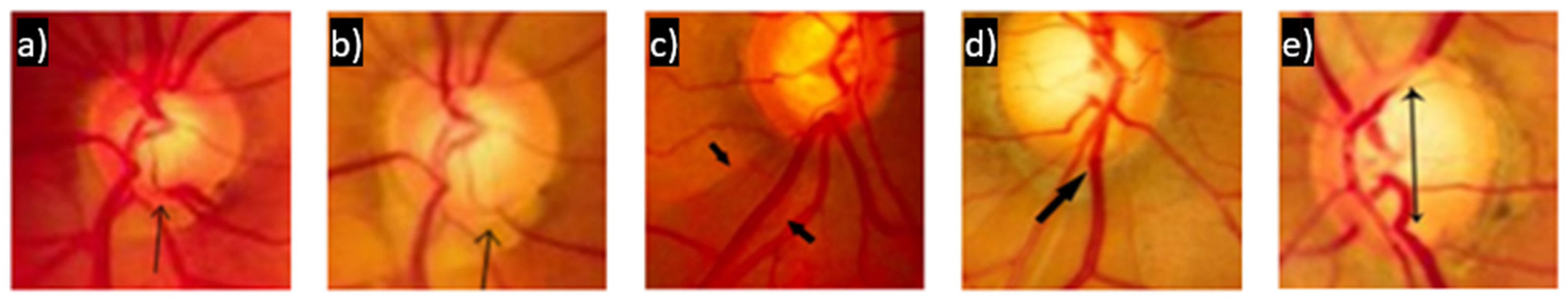 Diagnostics 12 00935 g005 Diagnostics 12 00935 g005