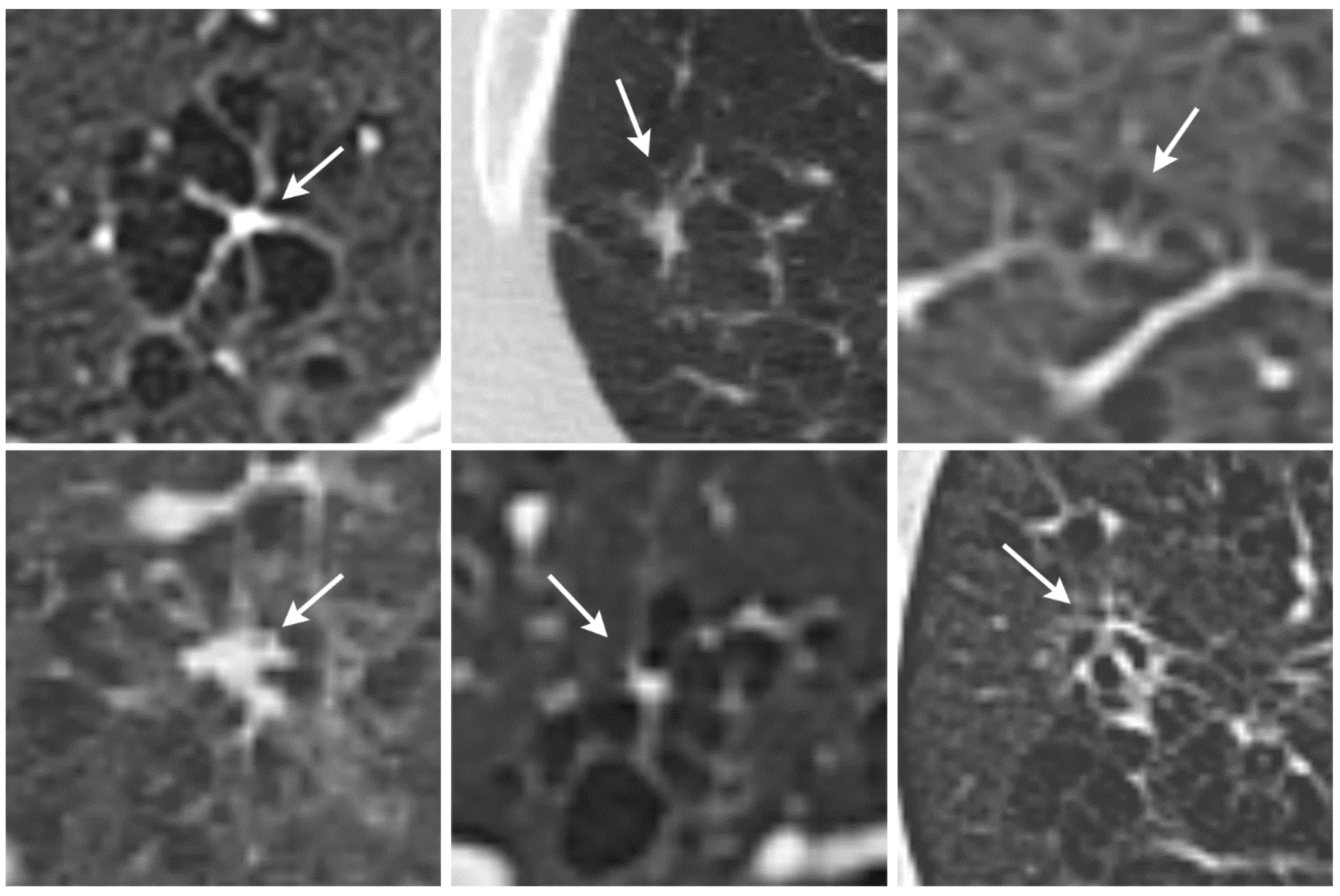 Diagnostics 12 00937 g002 550