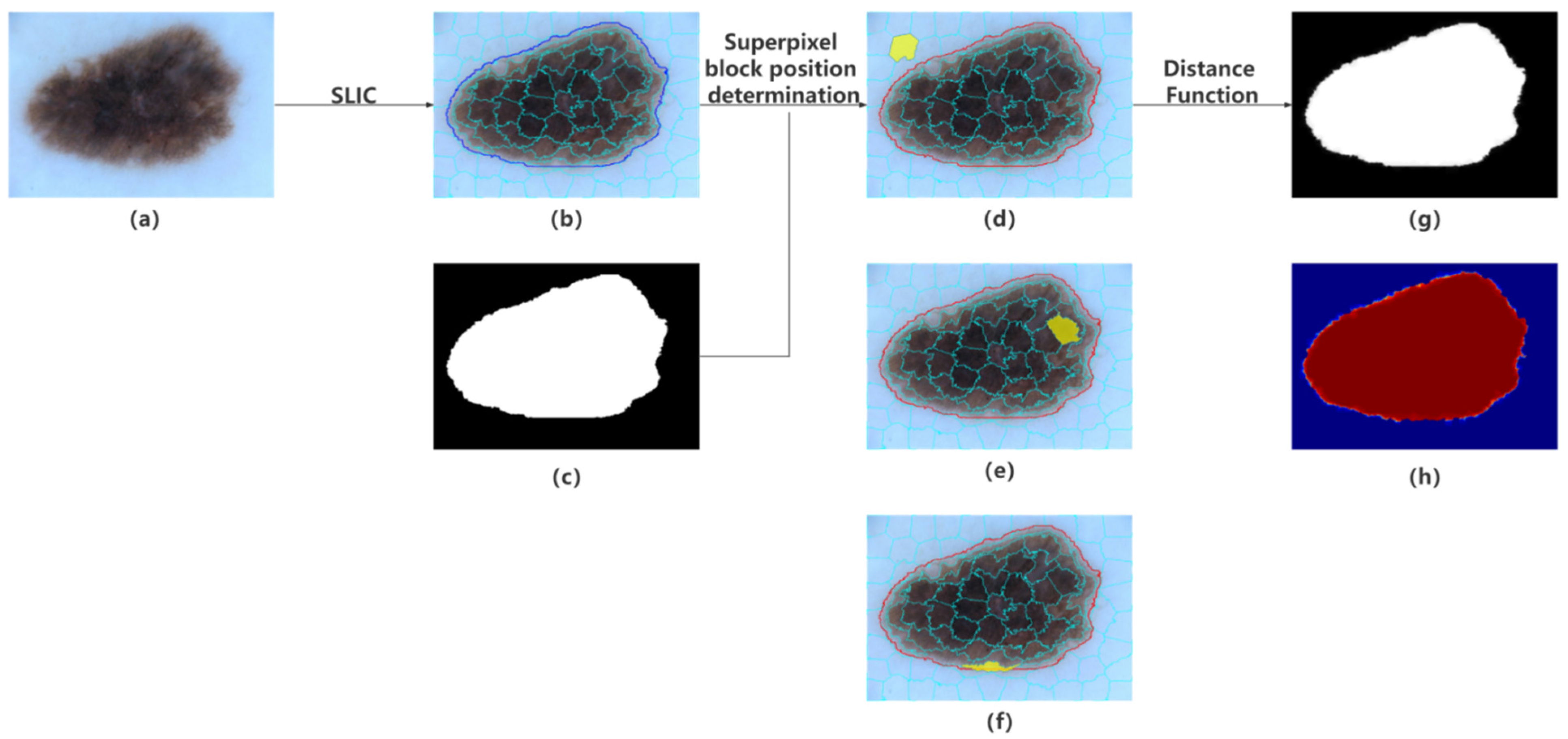 Diagnostics 12 00938 g004