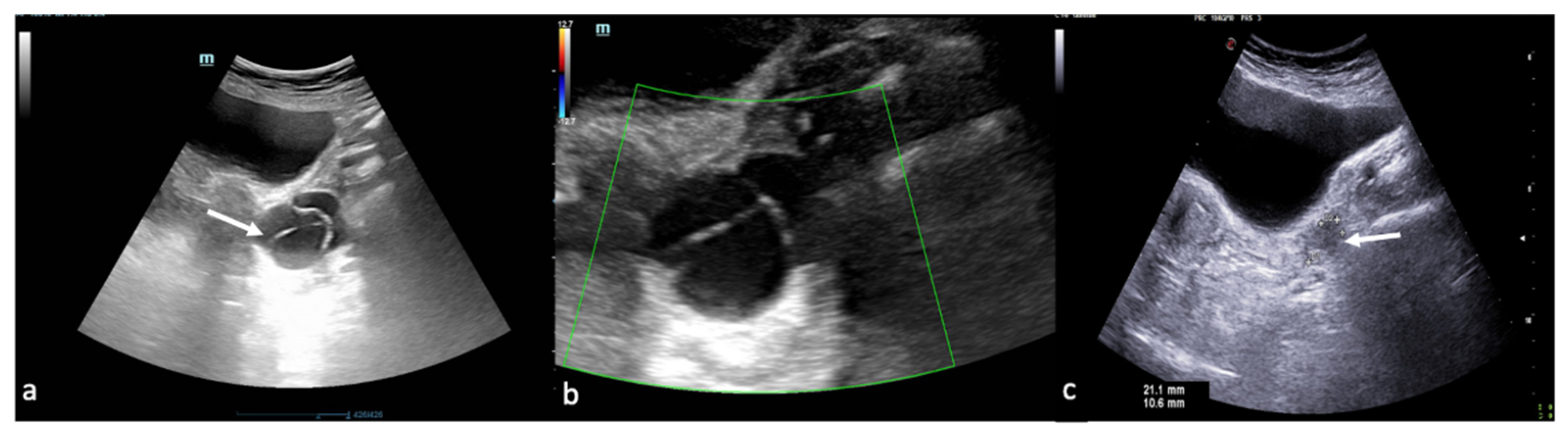 Diagnostics 12 00939 g004