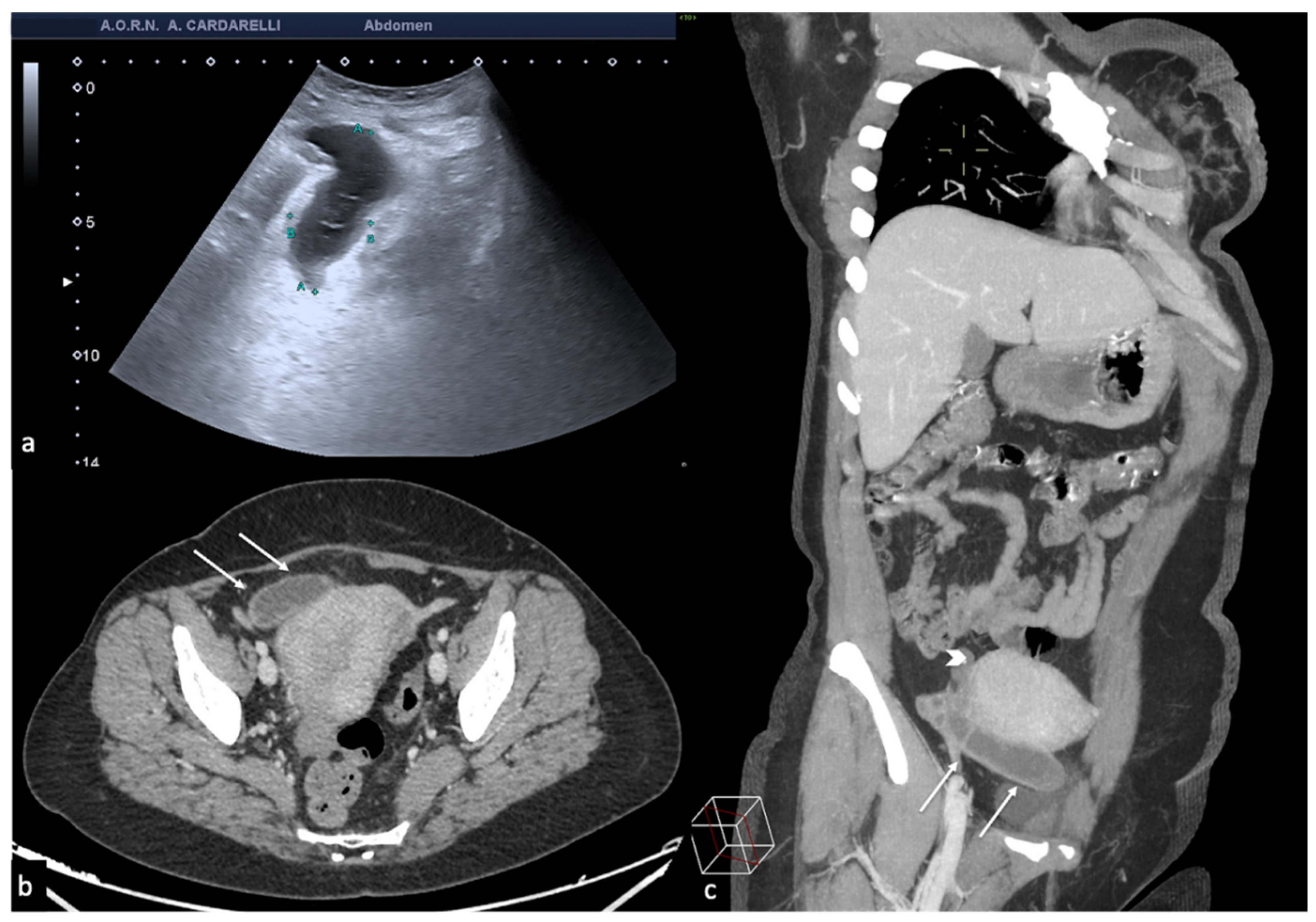Diagnostics 12 00939 g005