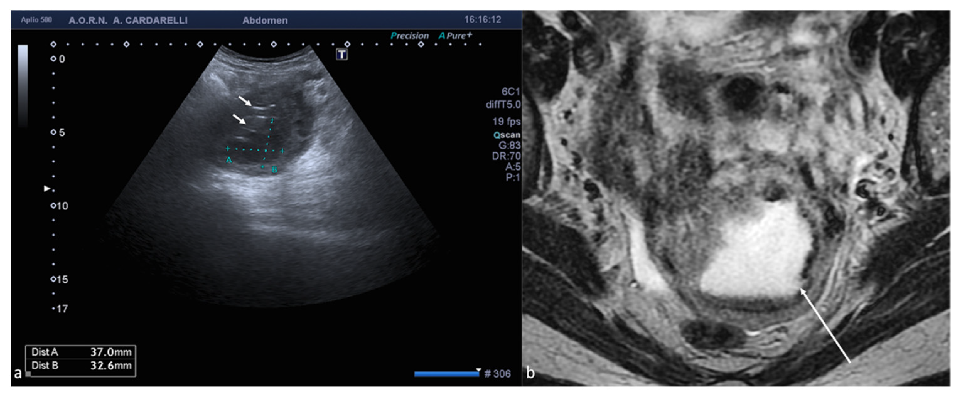 Diagnostics 12 00939 g007