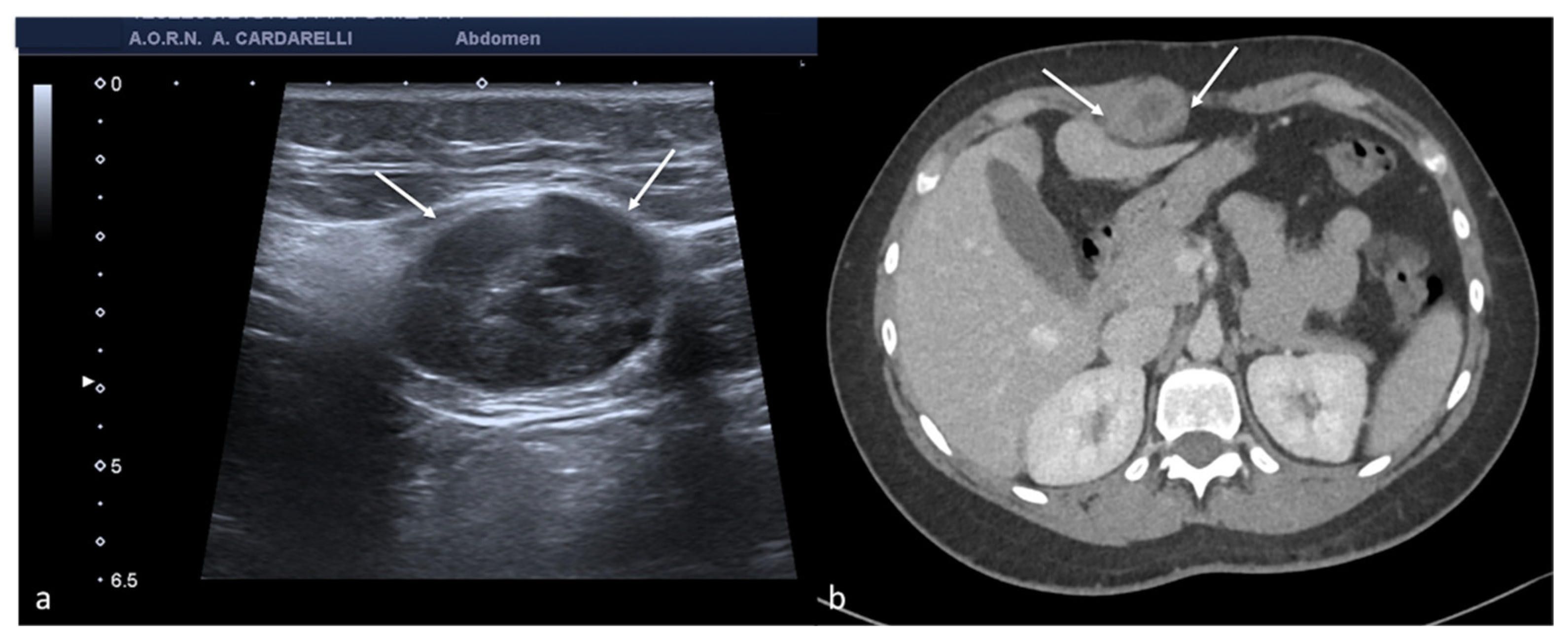 Diagnostics 12 00939 g009