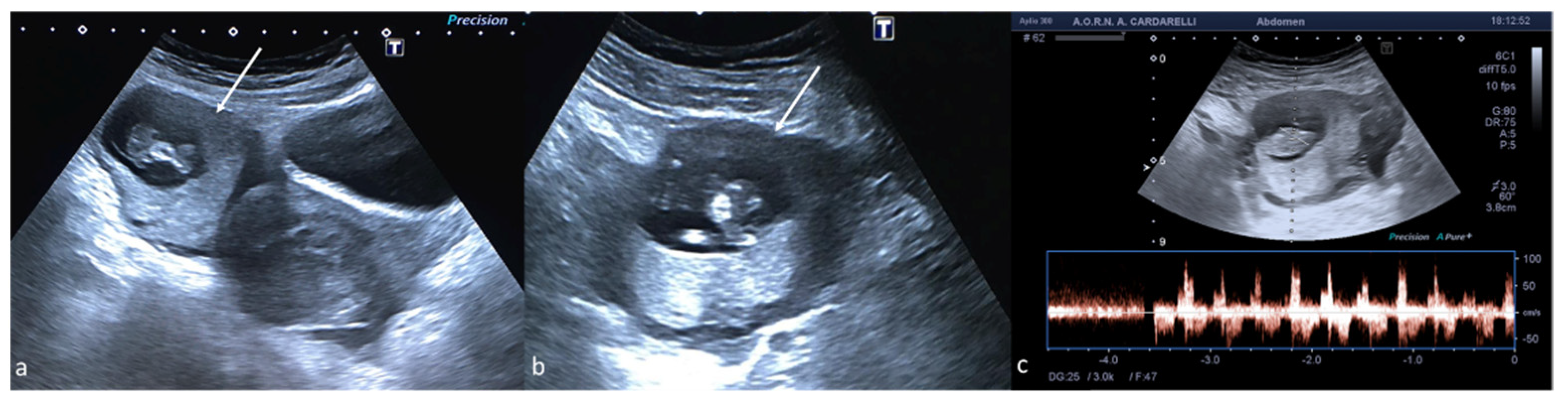 Diagnostics 12 00939 g012