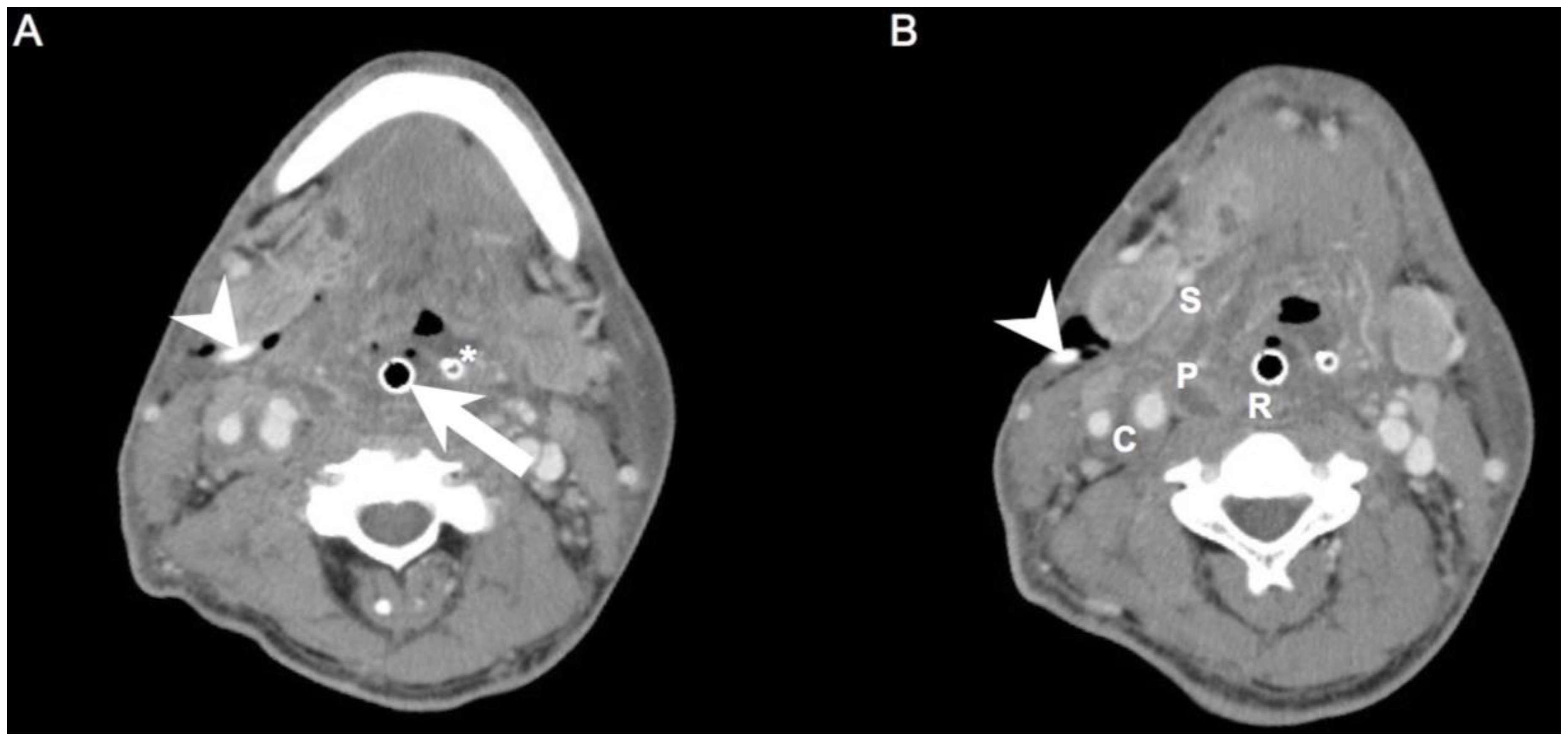 Diagnostics 12 00940 g001