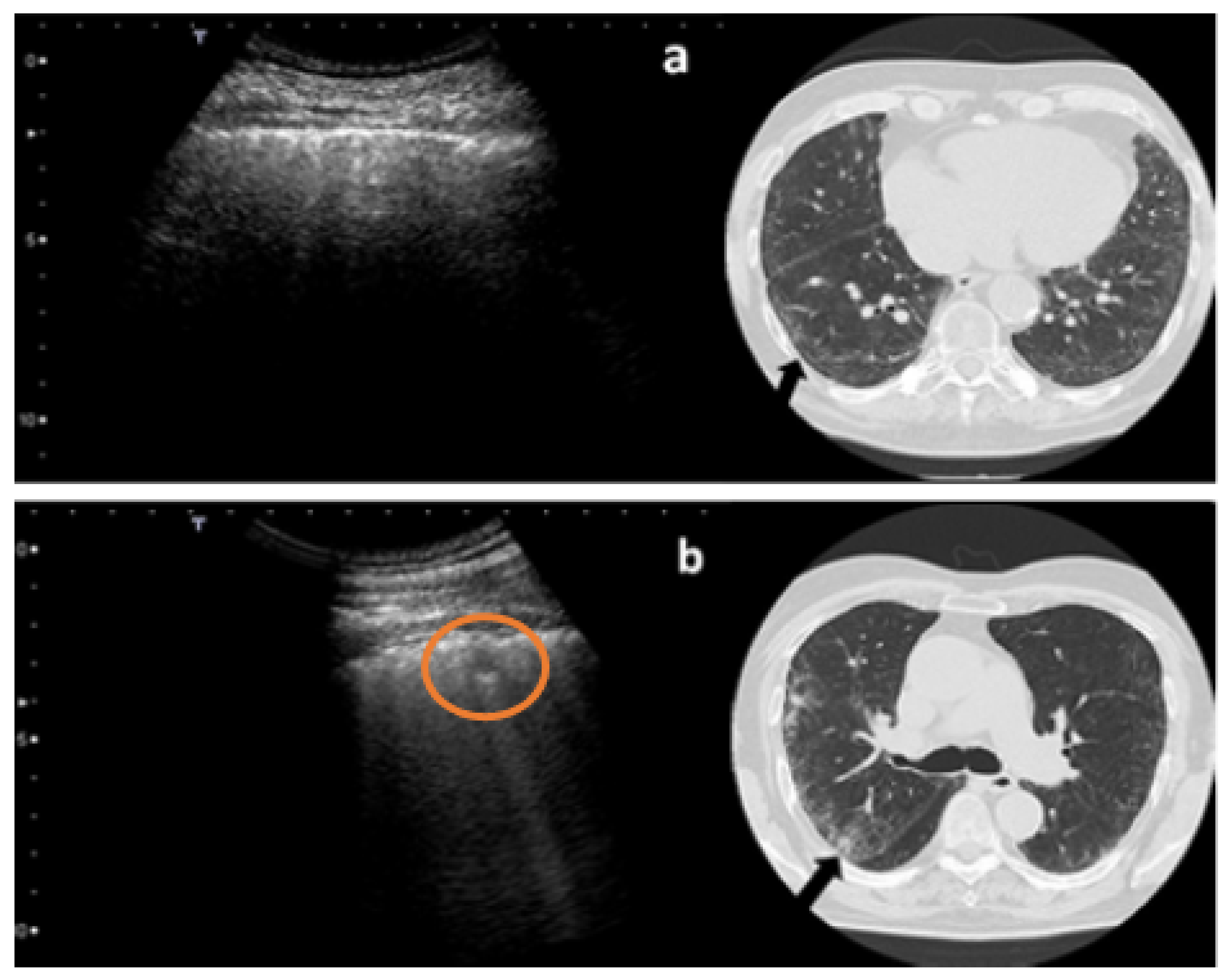 Diagnostics 12 00952 g003 550