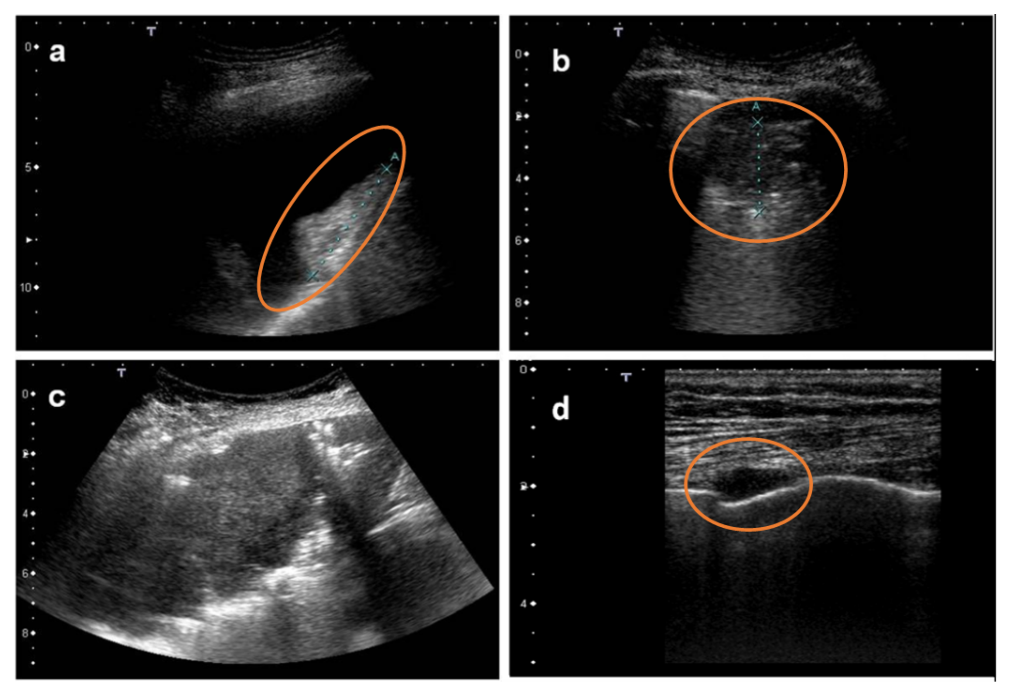 Diagnostics 12 00952 g004 550
