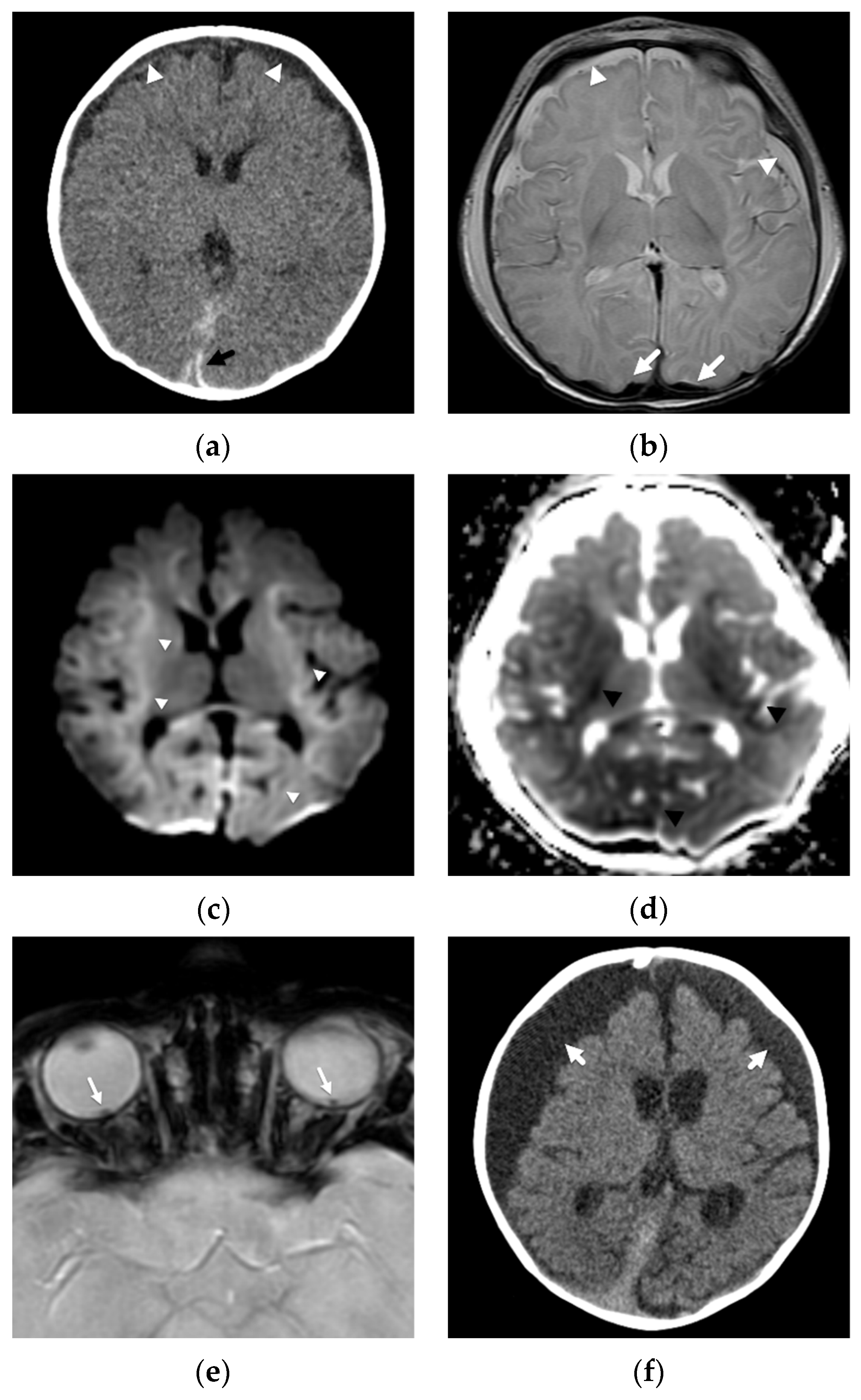 Diagnostics 12 00955 g001 550