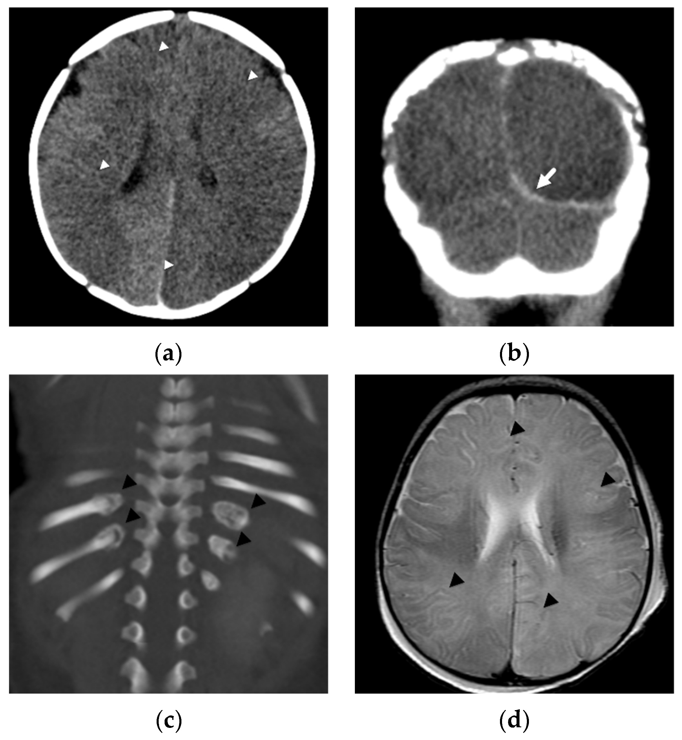 Diagnostics 12 00955 g002a 550