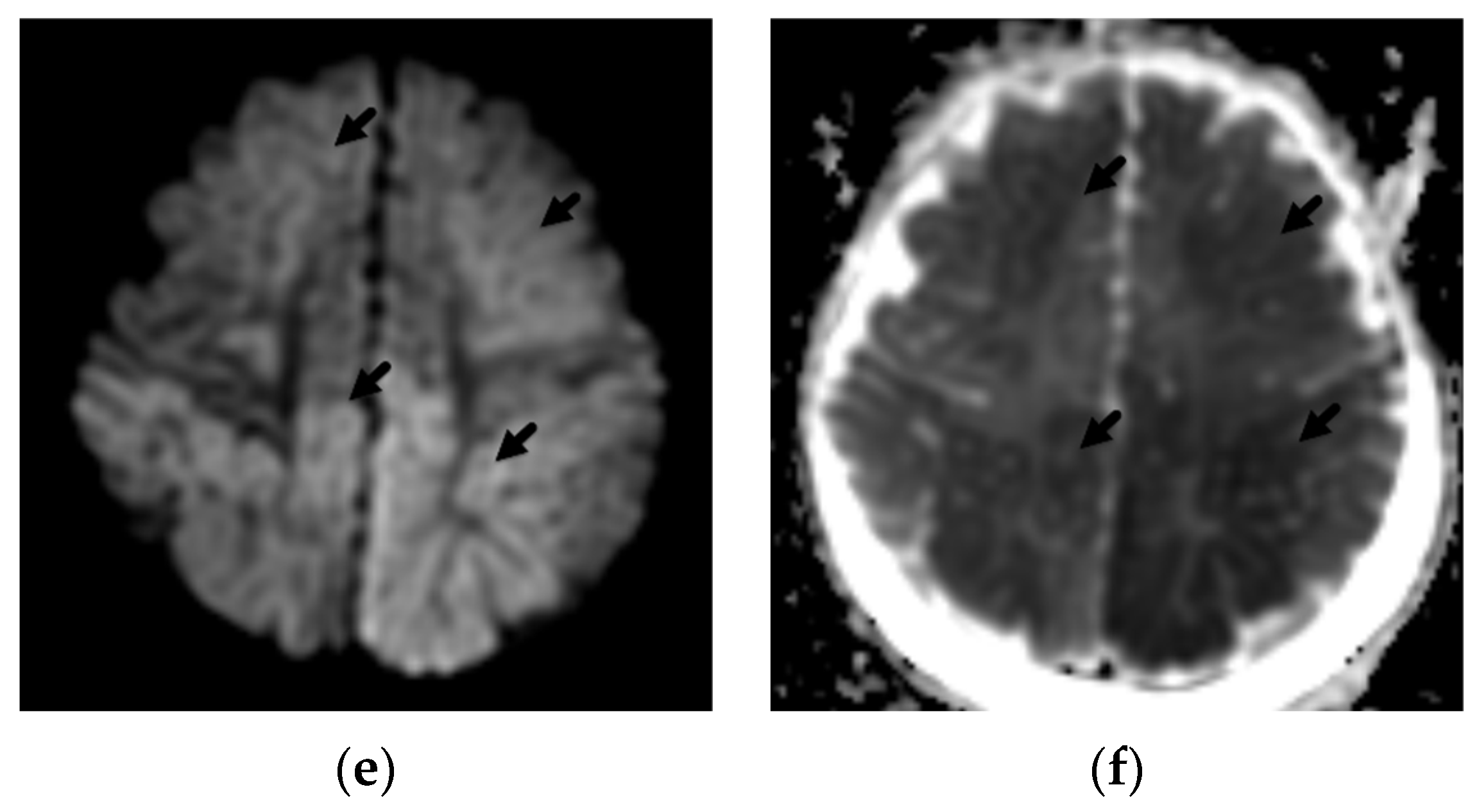 Diagnostics 12 00955 g002b 550