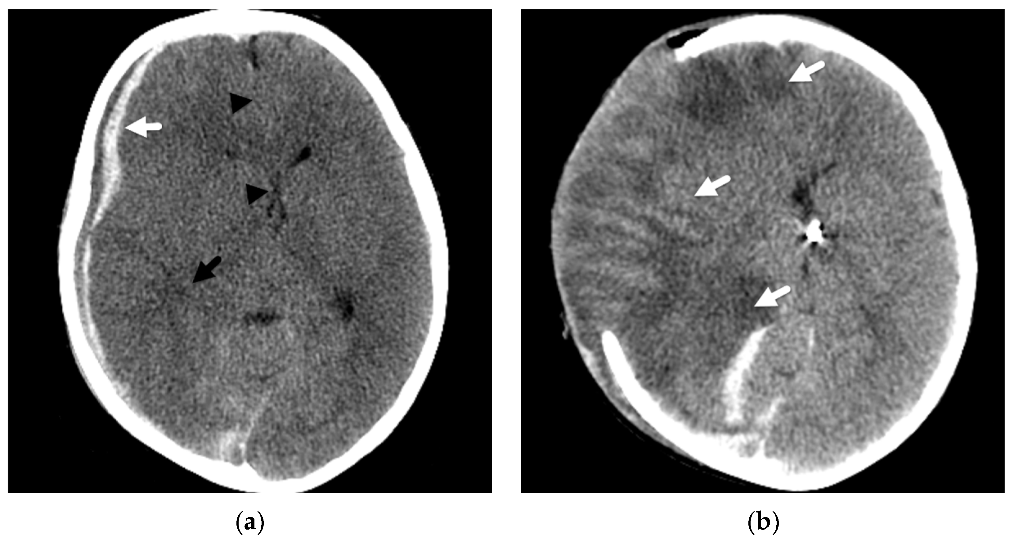 Diagnostics 12 00955 g003 550