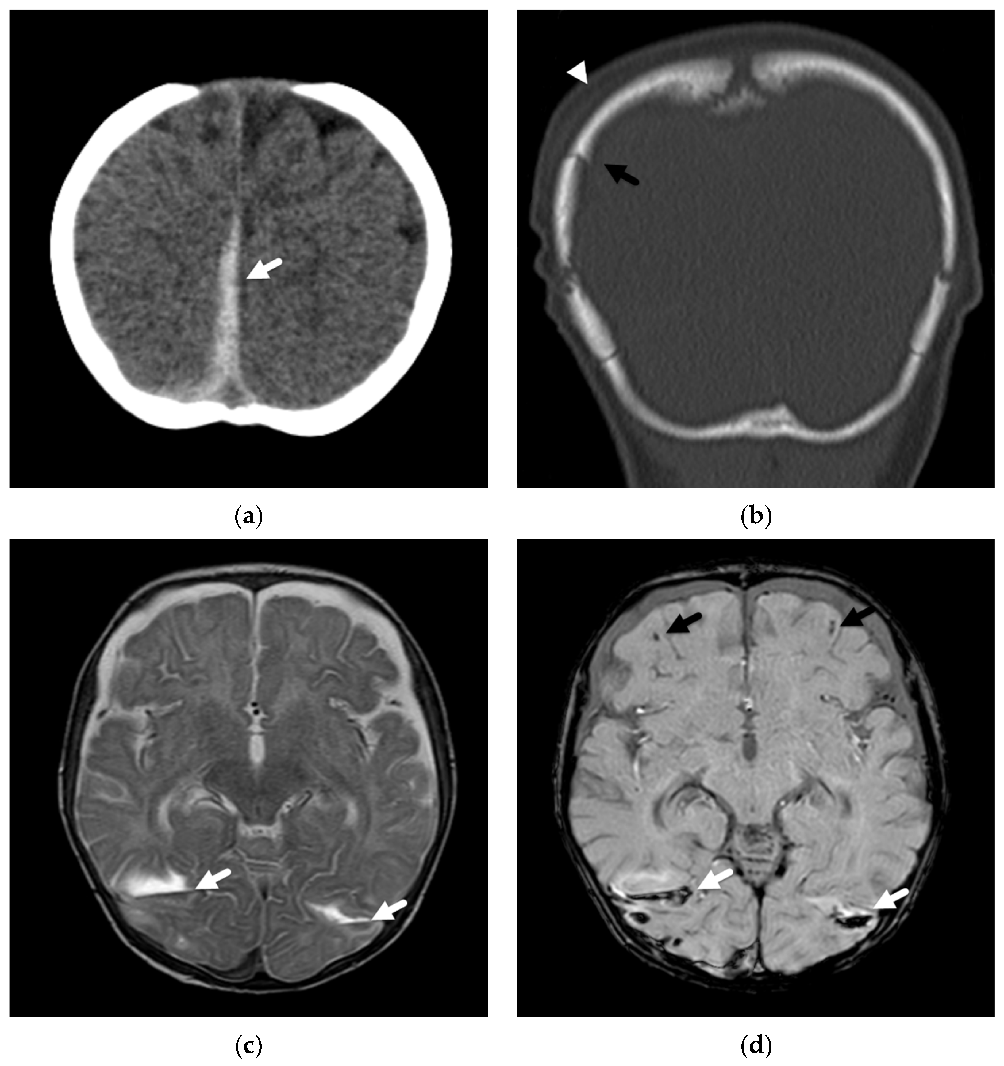 Diagnostics 12 00955 g004 550