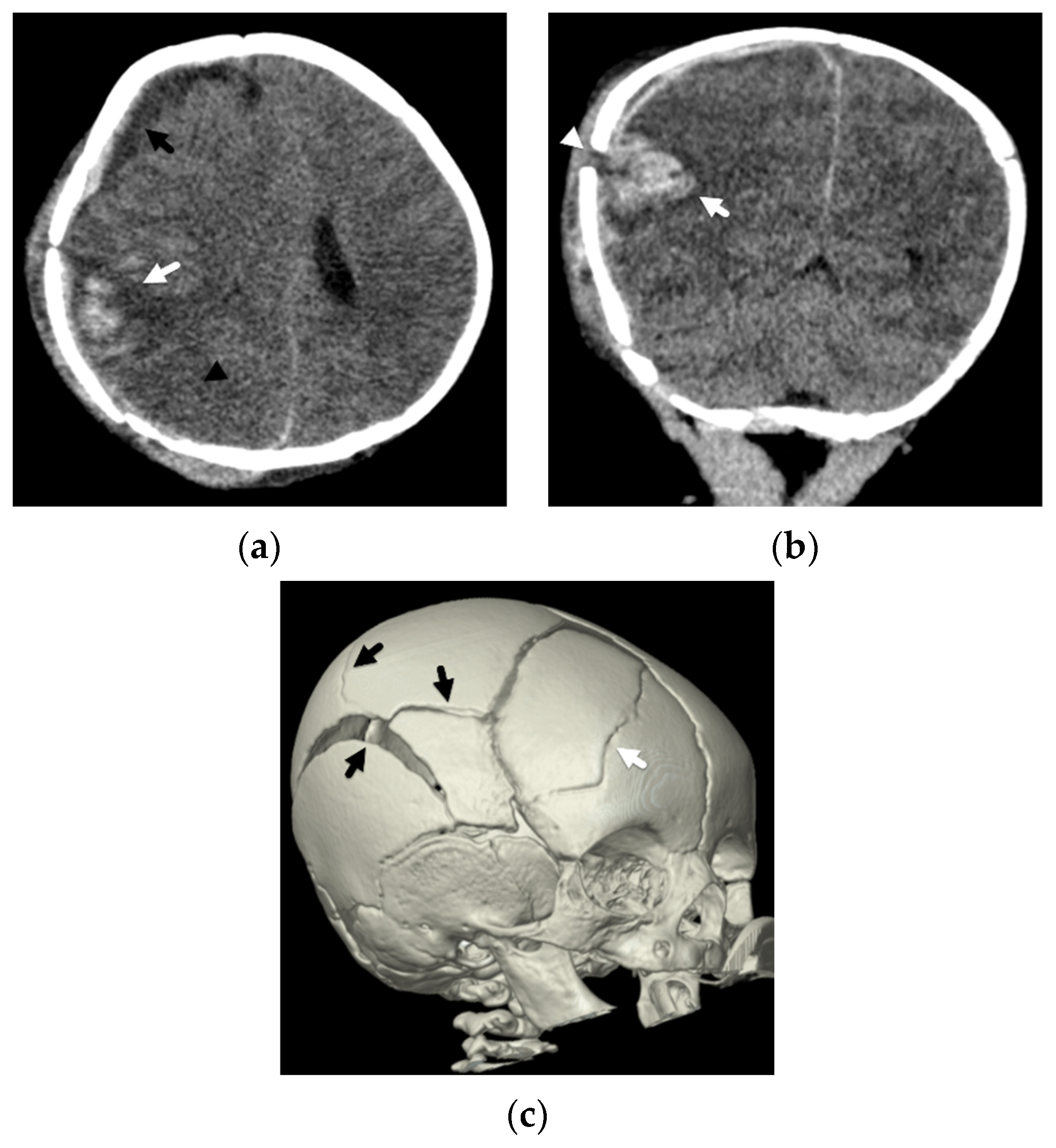 Diagnostics 12 00955 g005 550