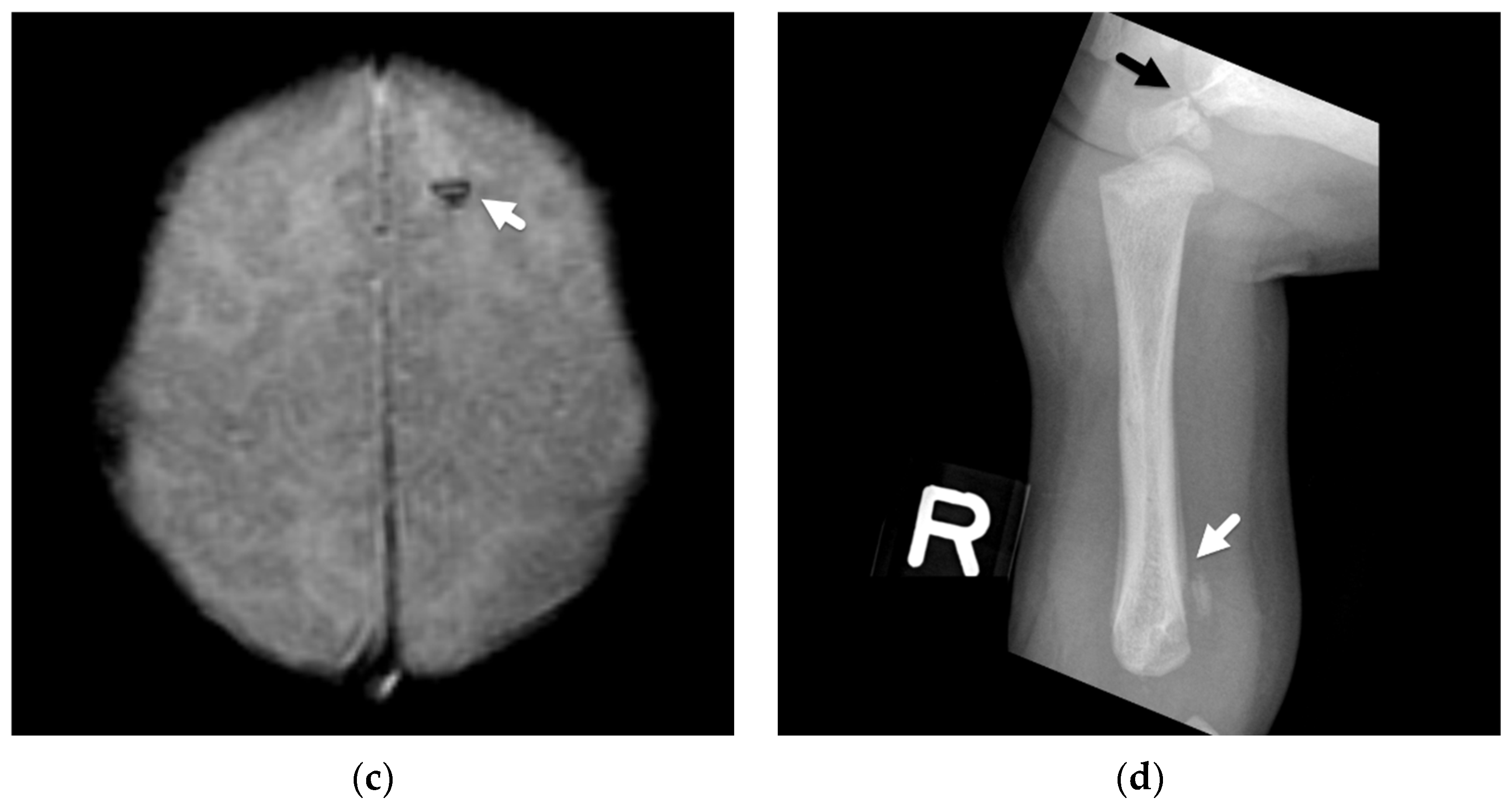 Diagnostics 12 00955 g006b 550