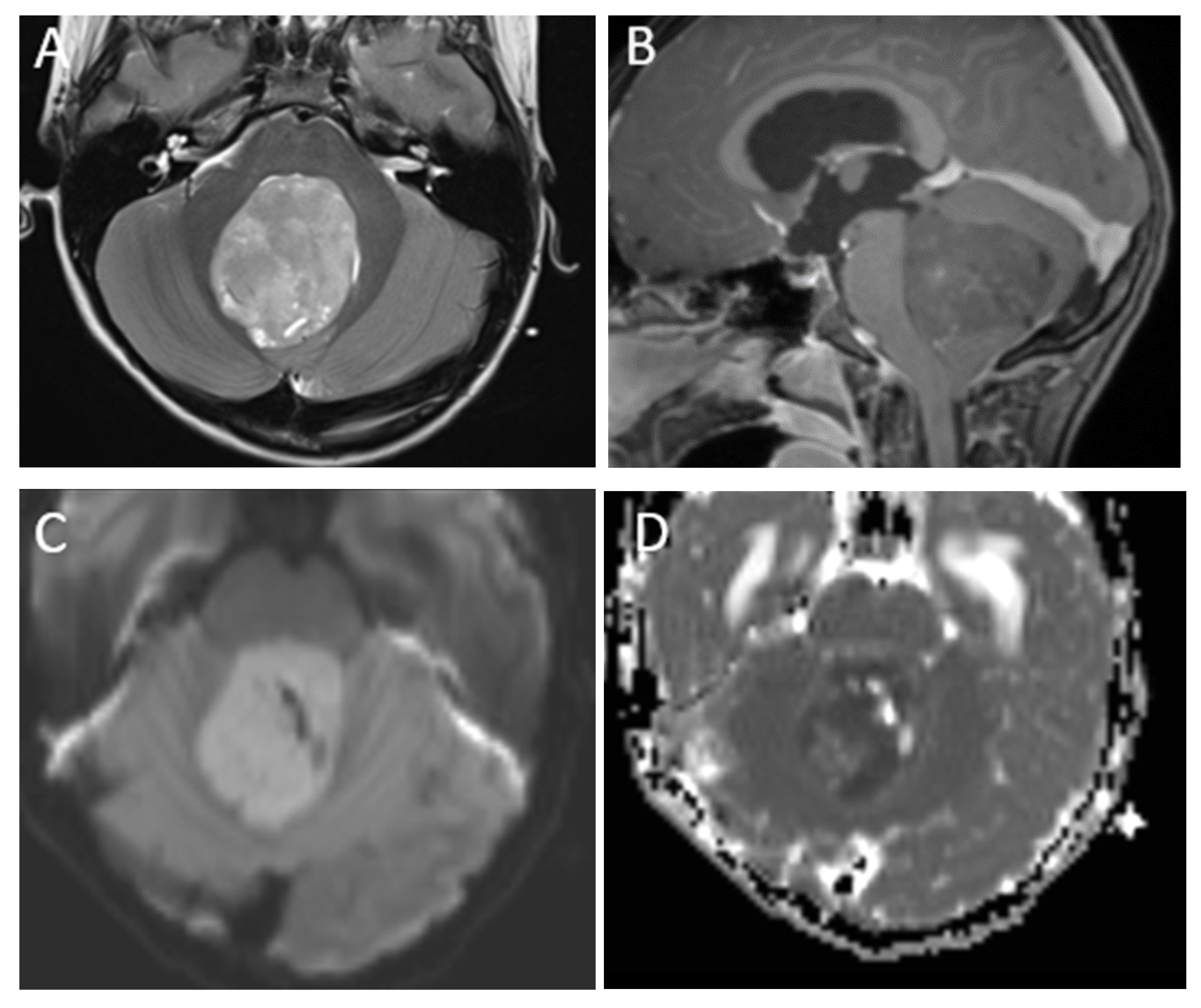 Diagnostics 12 00961 g001a
