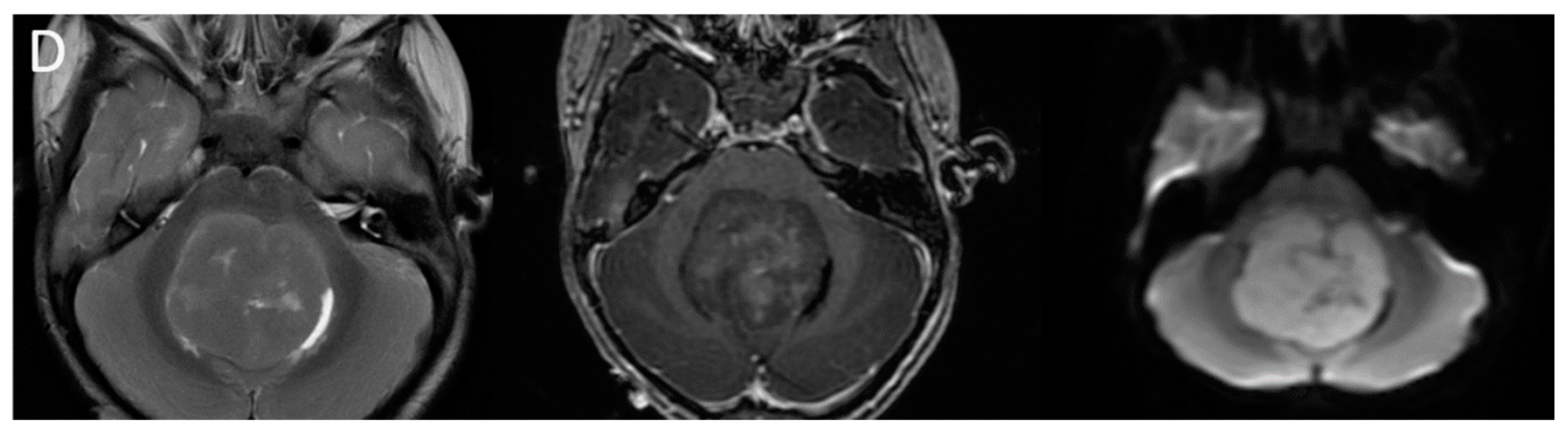 Diagnostics 12 00961 g003b