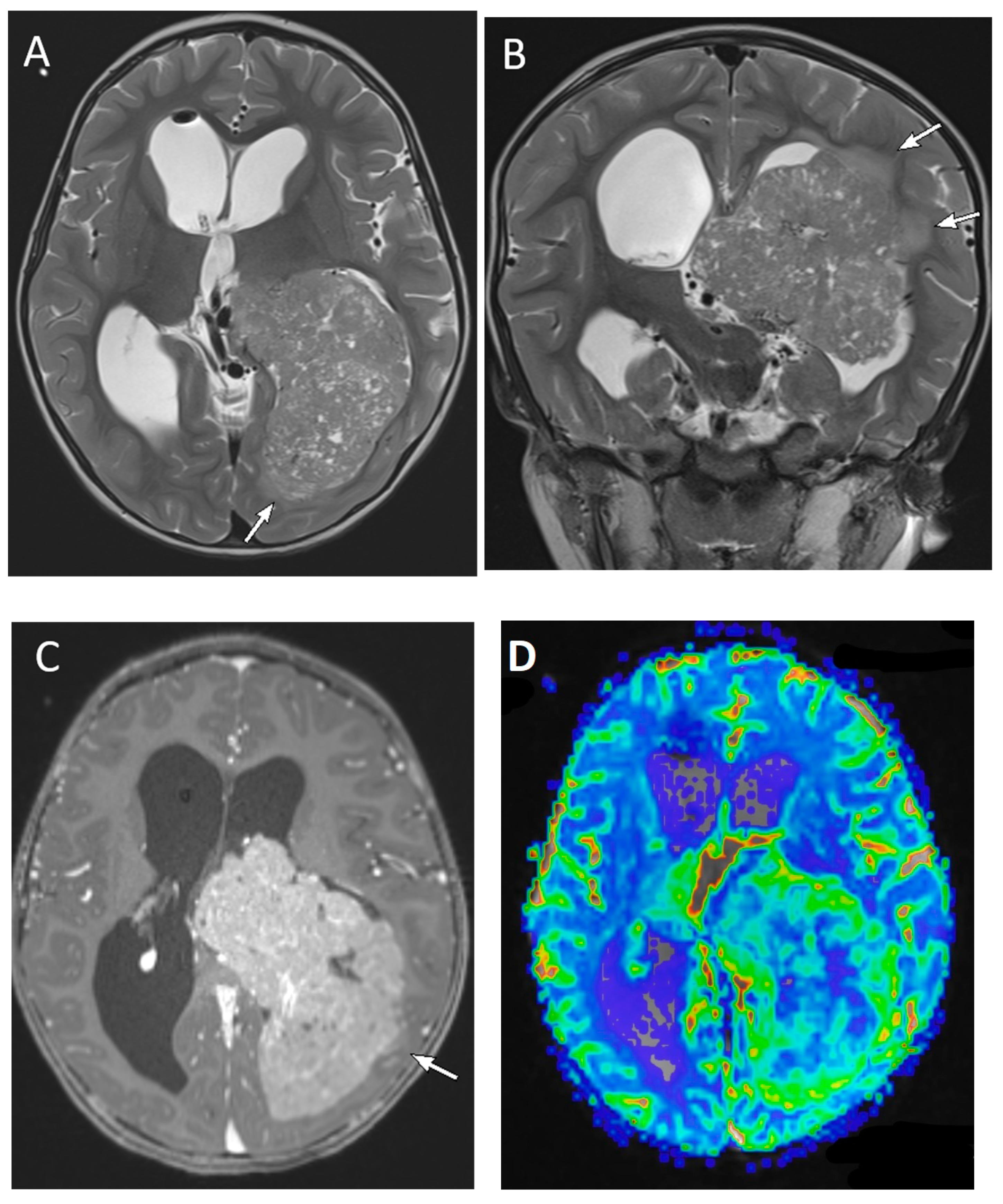 Diagnostics 12 00961 g011