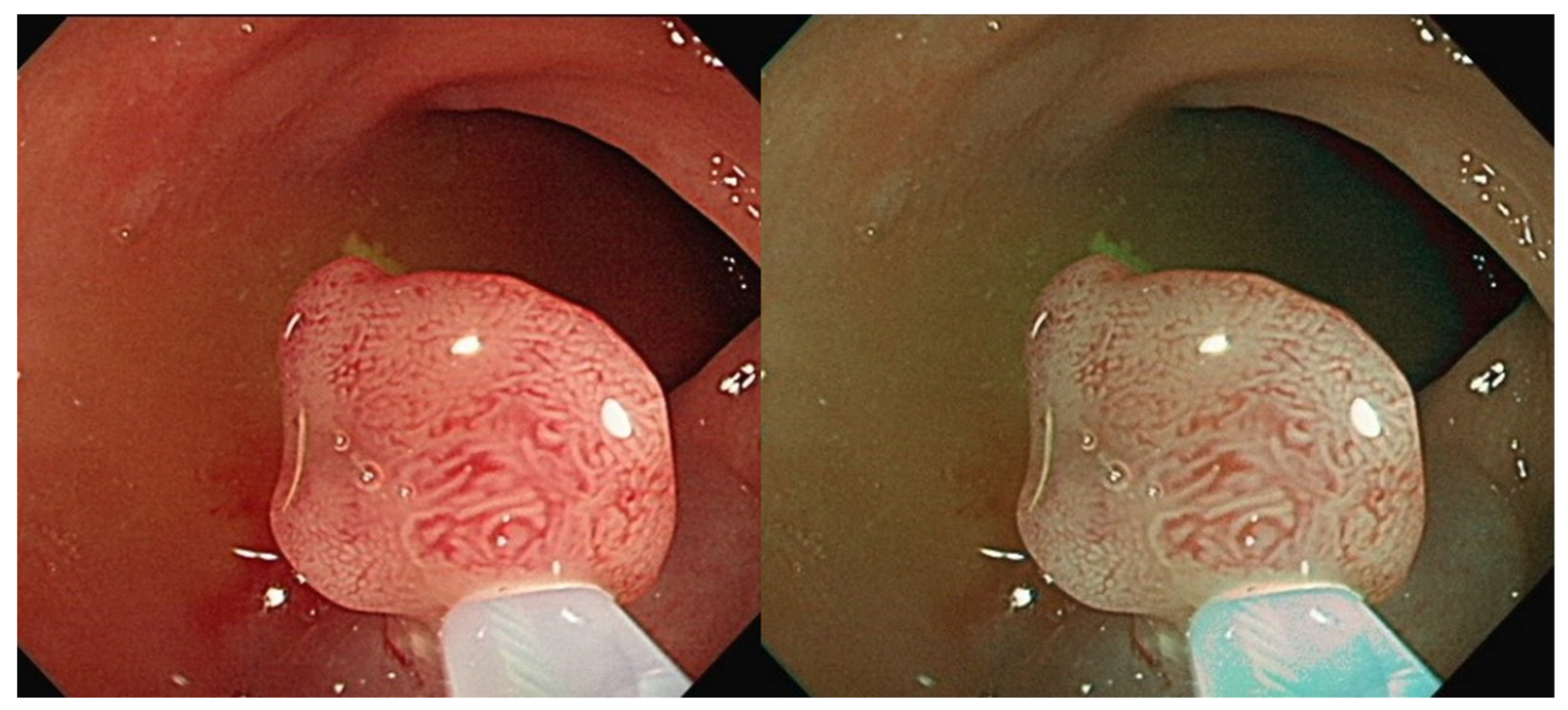 Diagnostics 12 00968 g003
